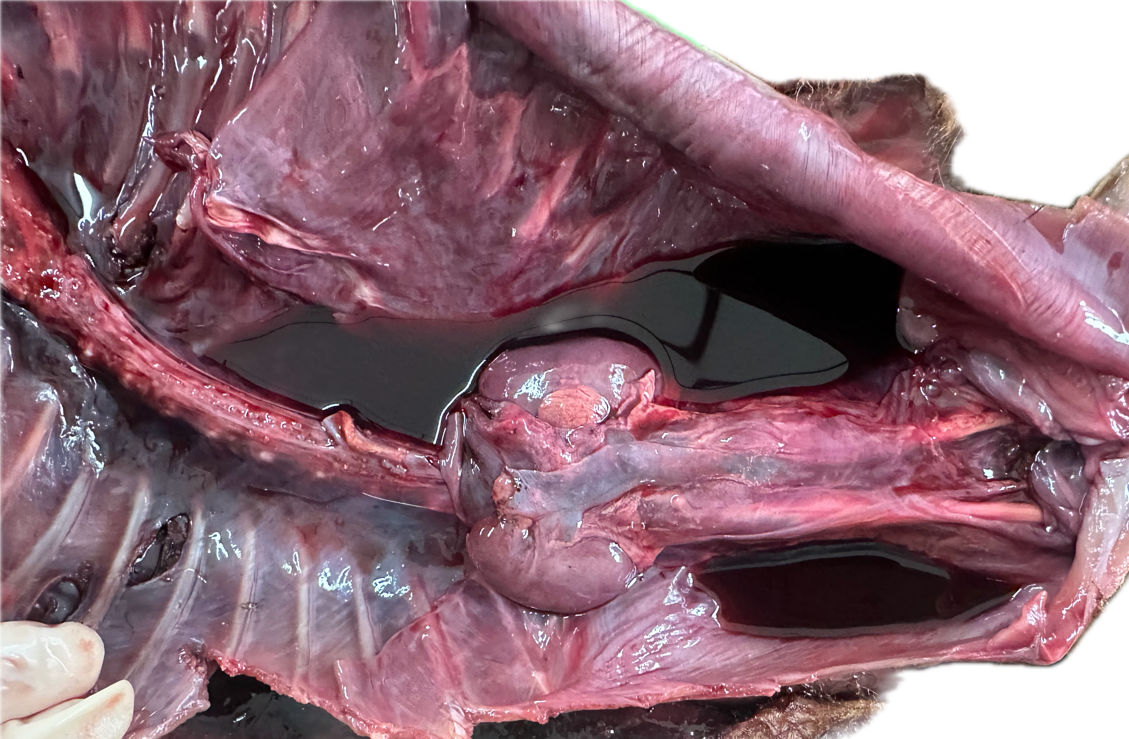 Abdomen Patológico 1