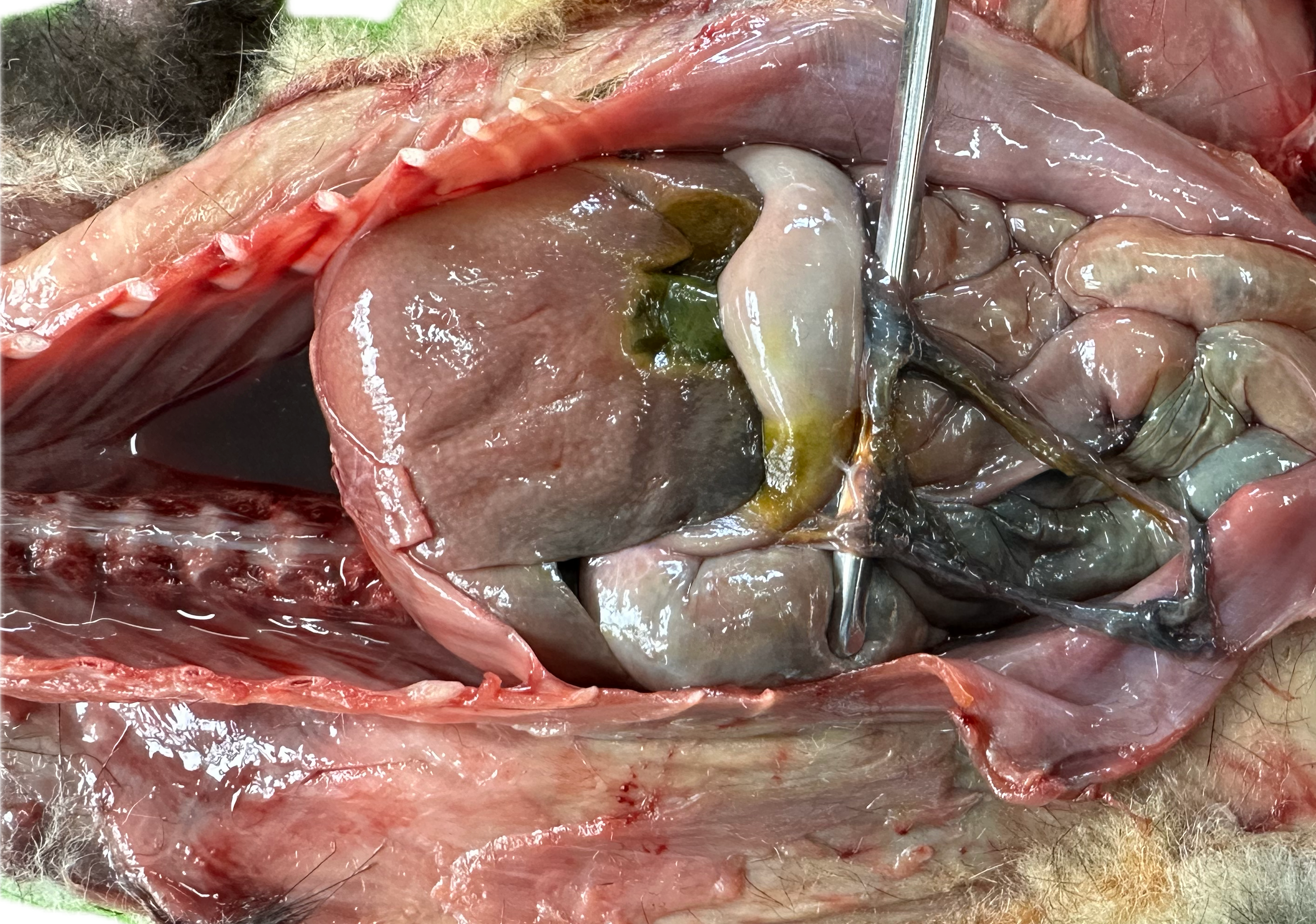 Abdomen Patológico 2