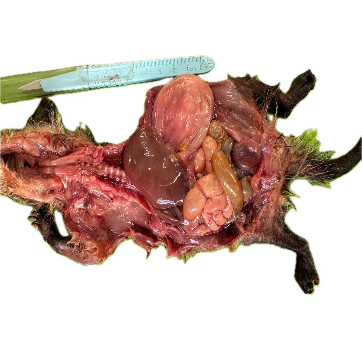 Patología Gástrica 15