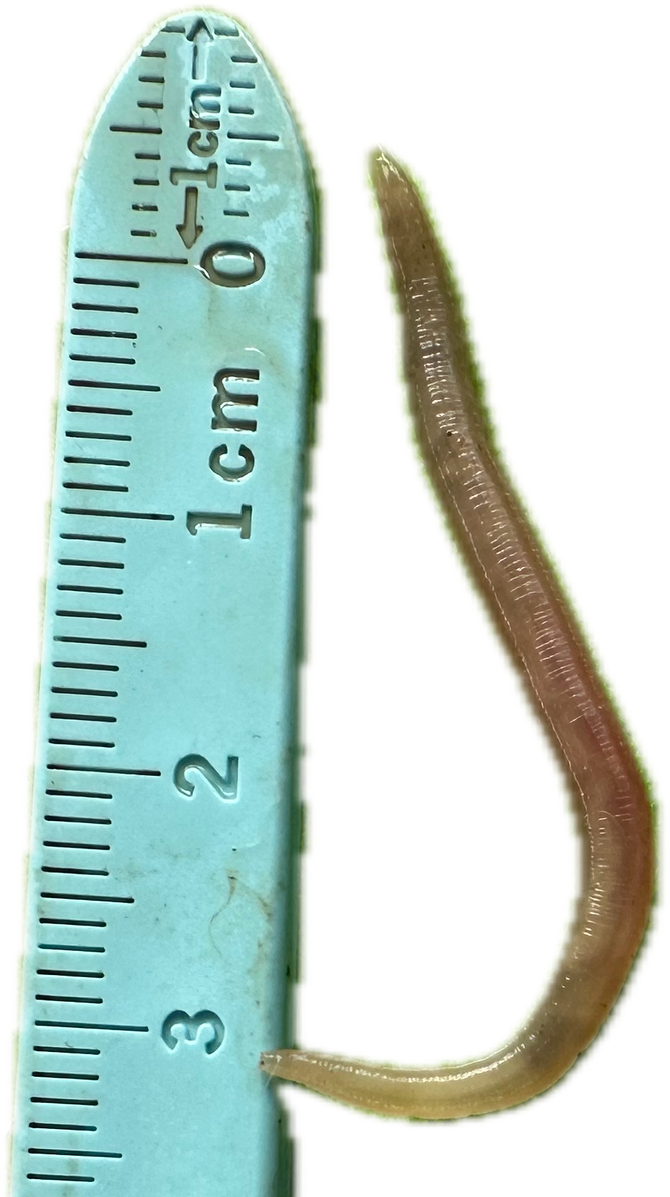 Patología Gástrica 17