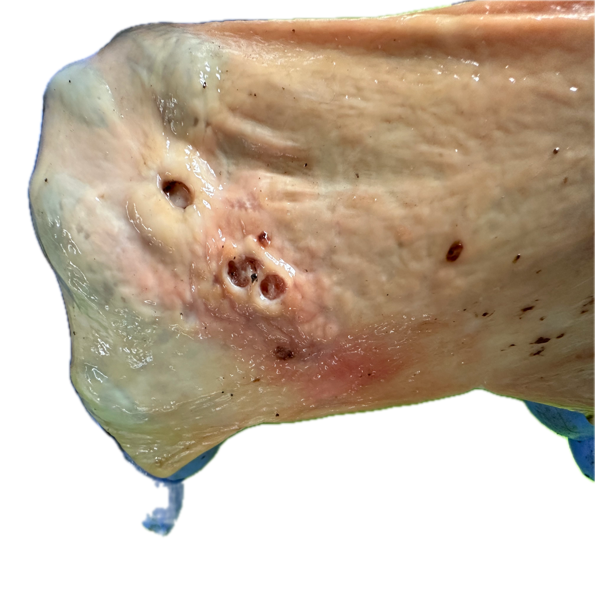 Patología Gástrica 27