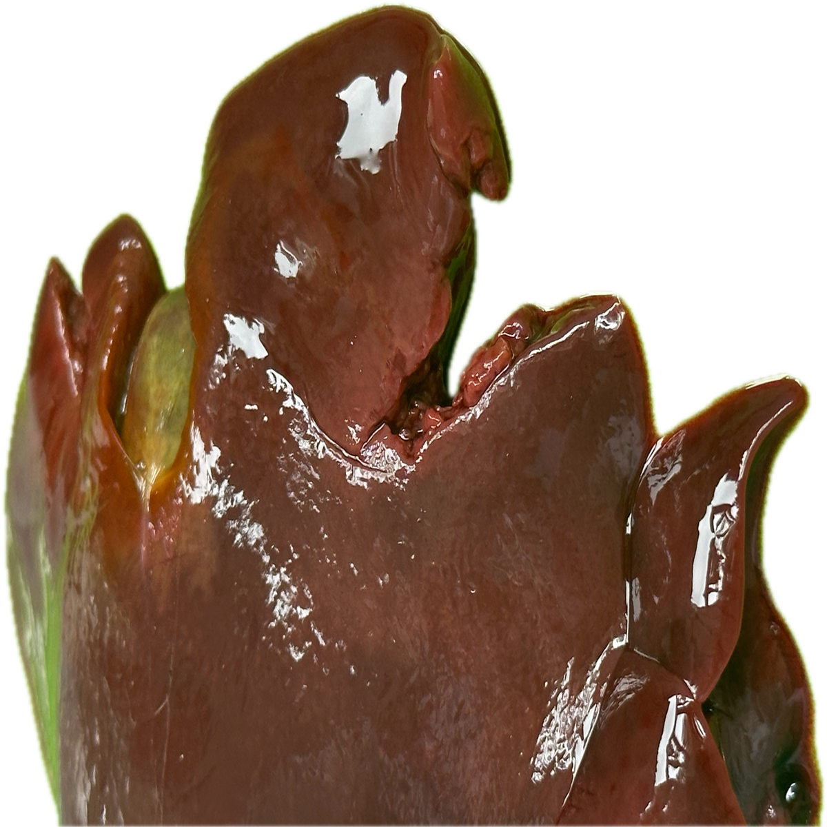 Patología Hepática 9