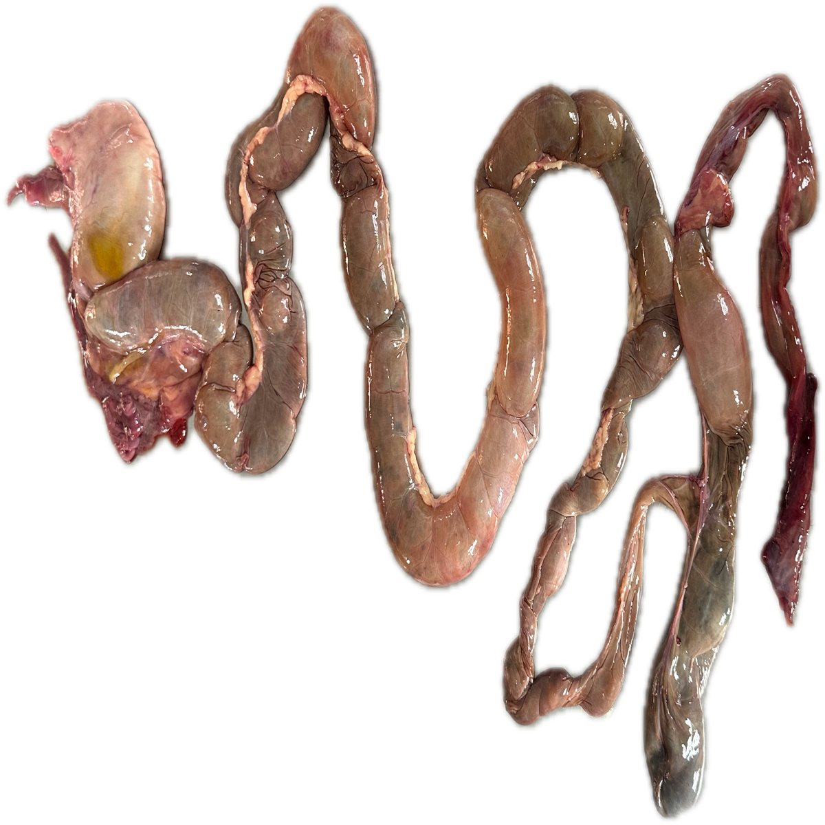 Intestino Delgado Normal 1