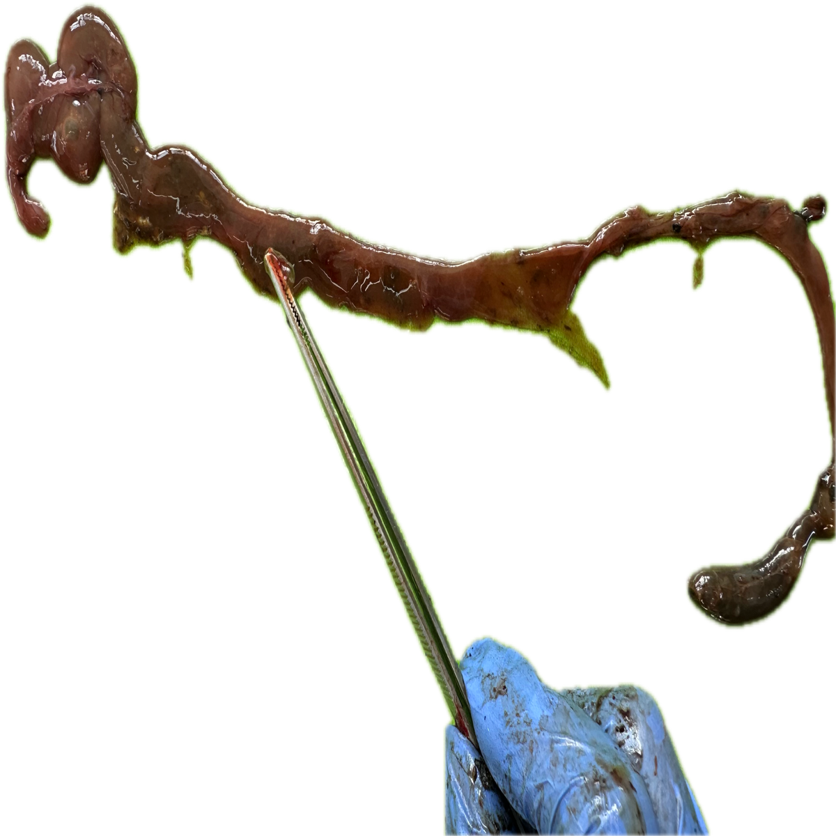 Patología Intestinal 4