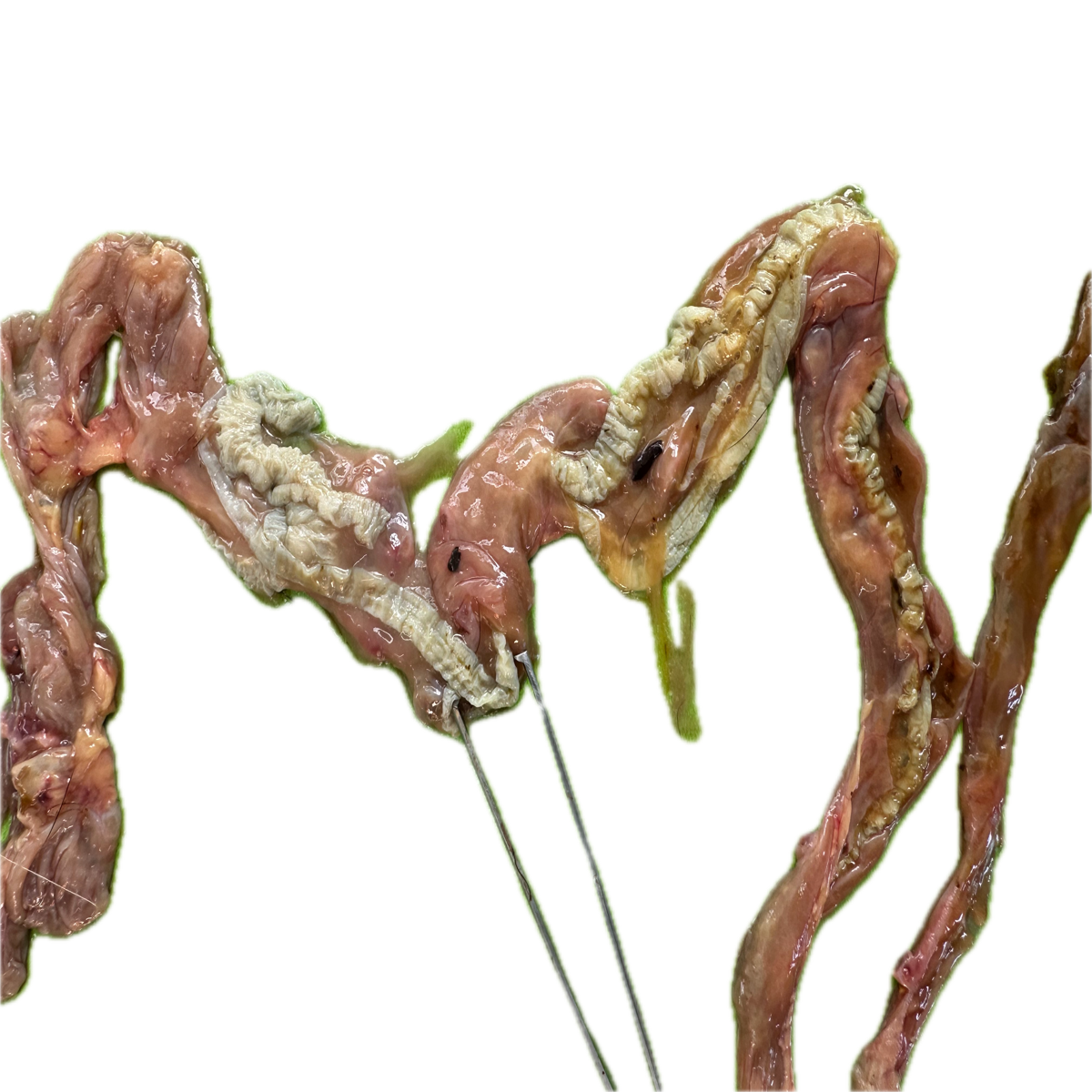 Patología Intestinal 6