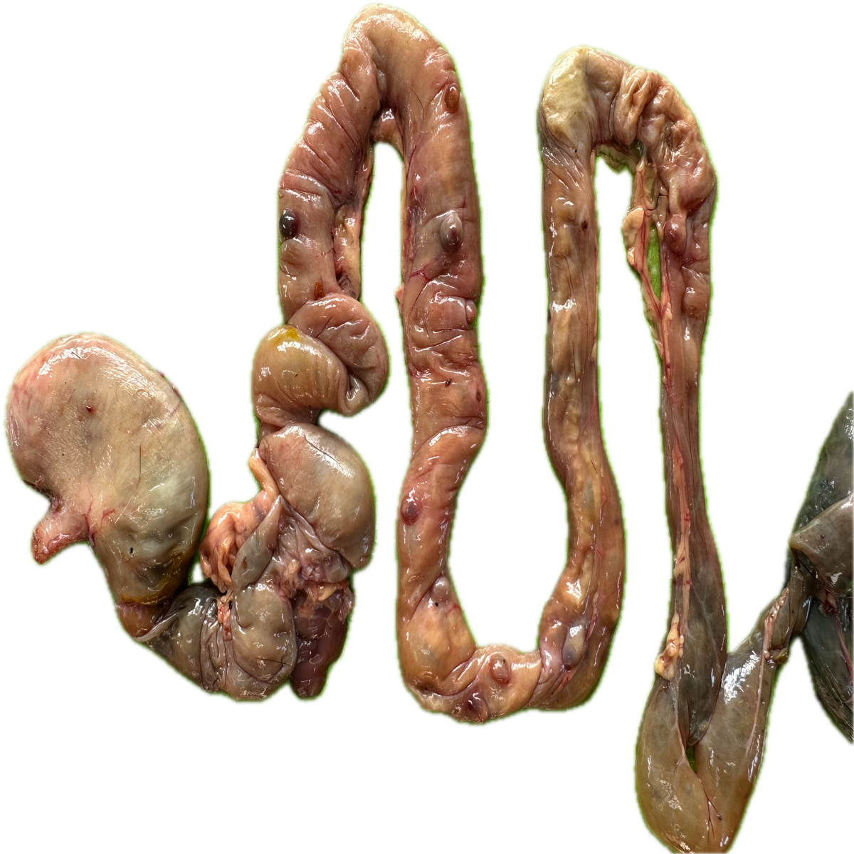 Patología Intestinal 7