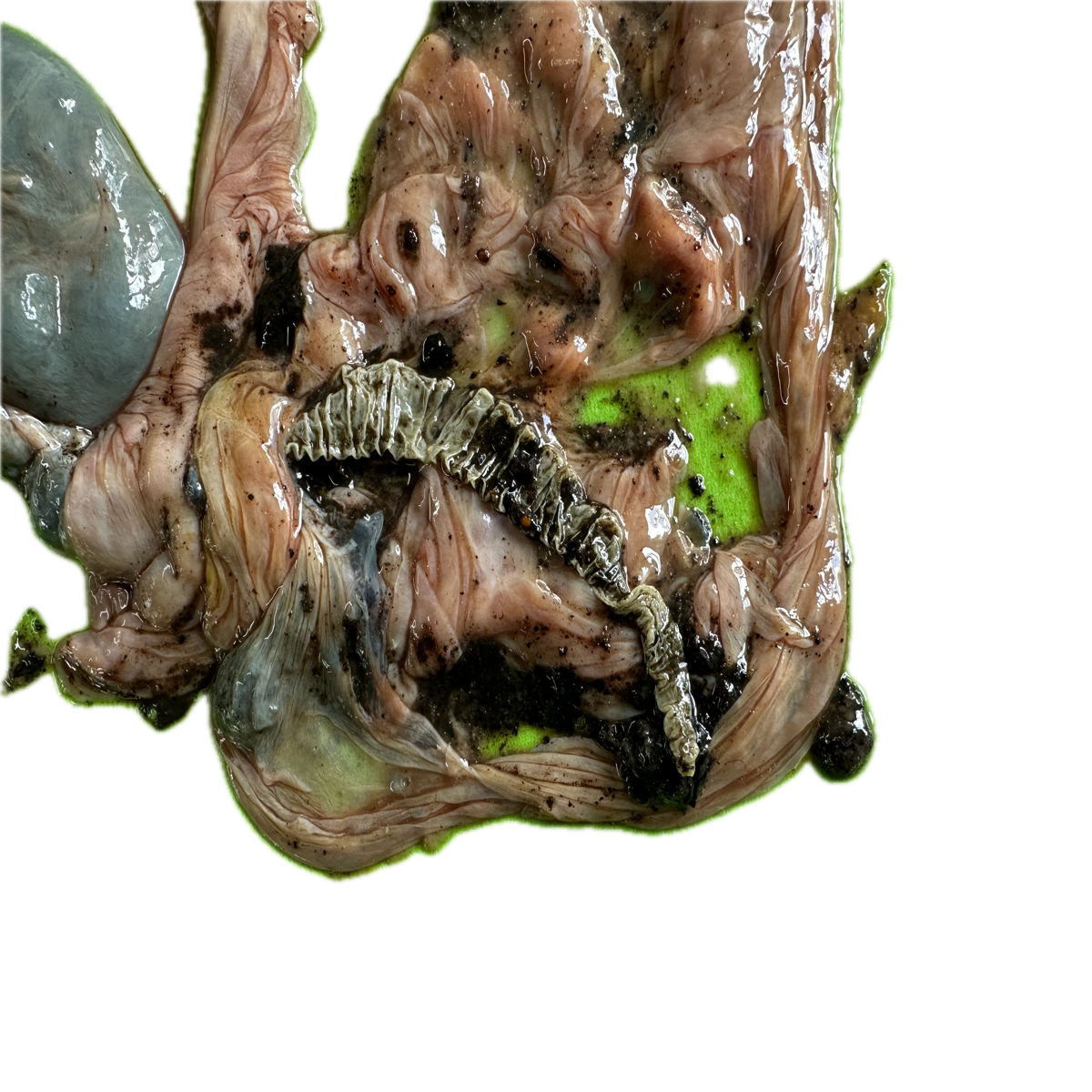 Patología Intestinal 9