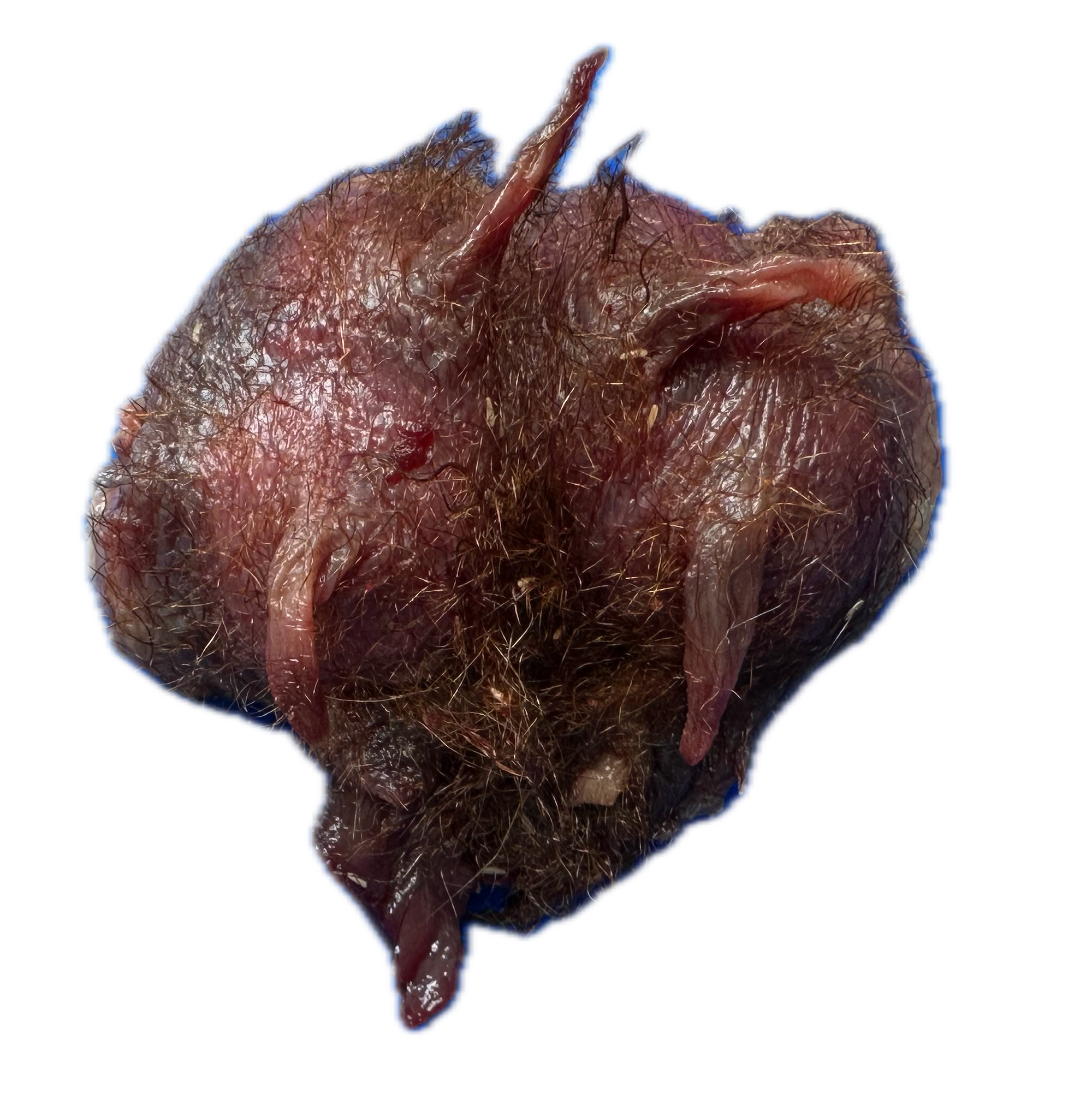 Glándula Normal 2