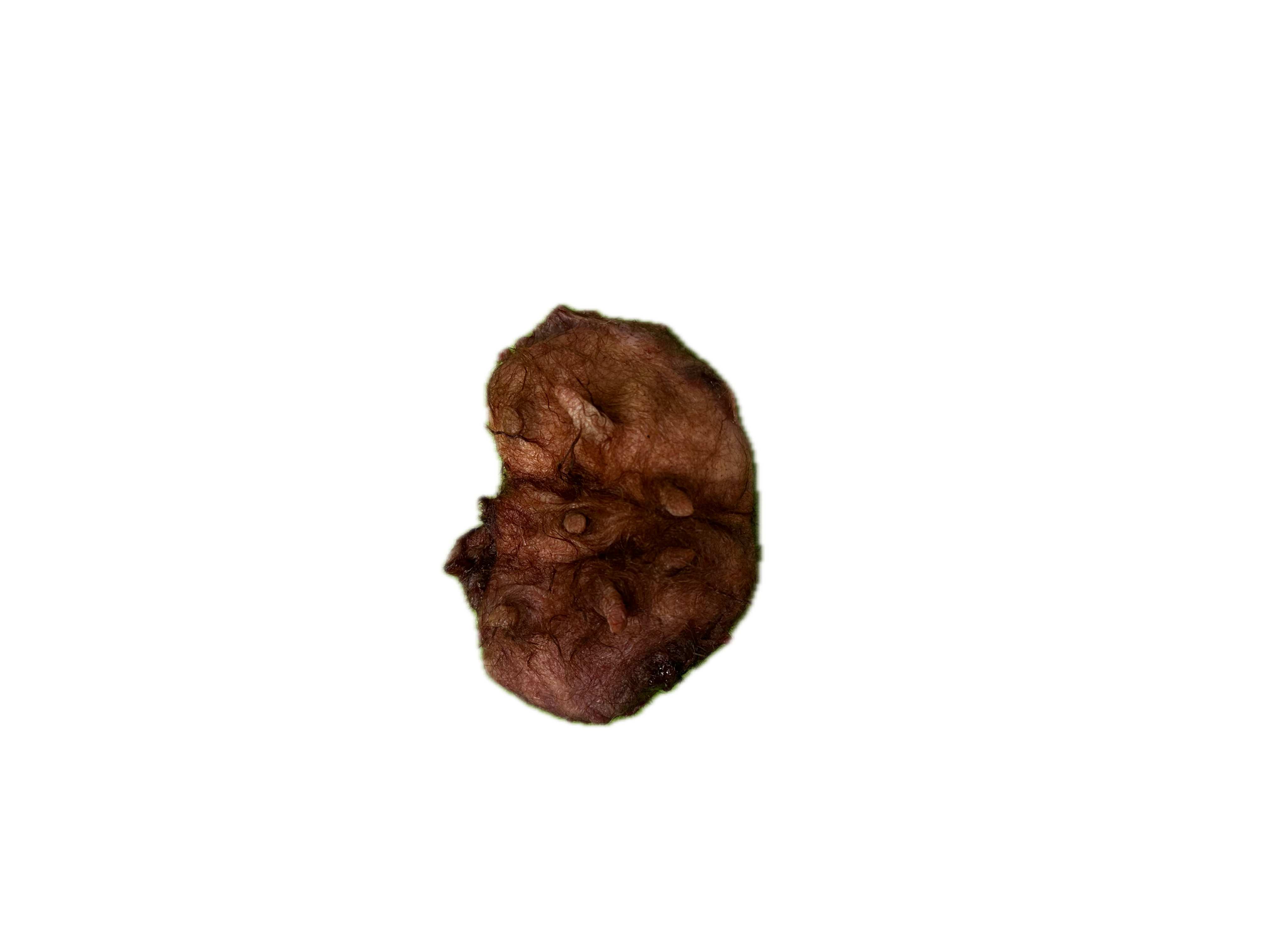 Glándula Normal 5