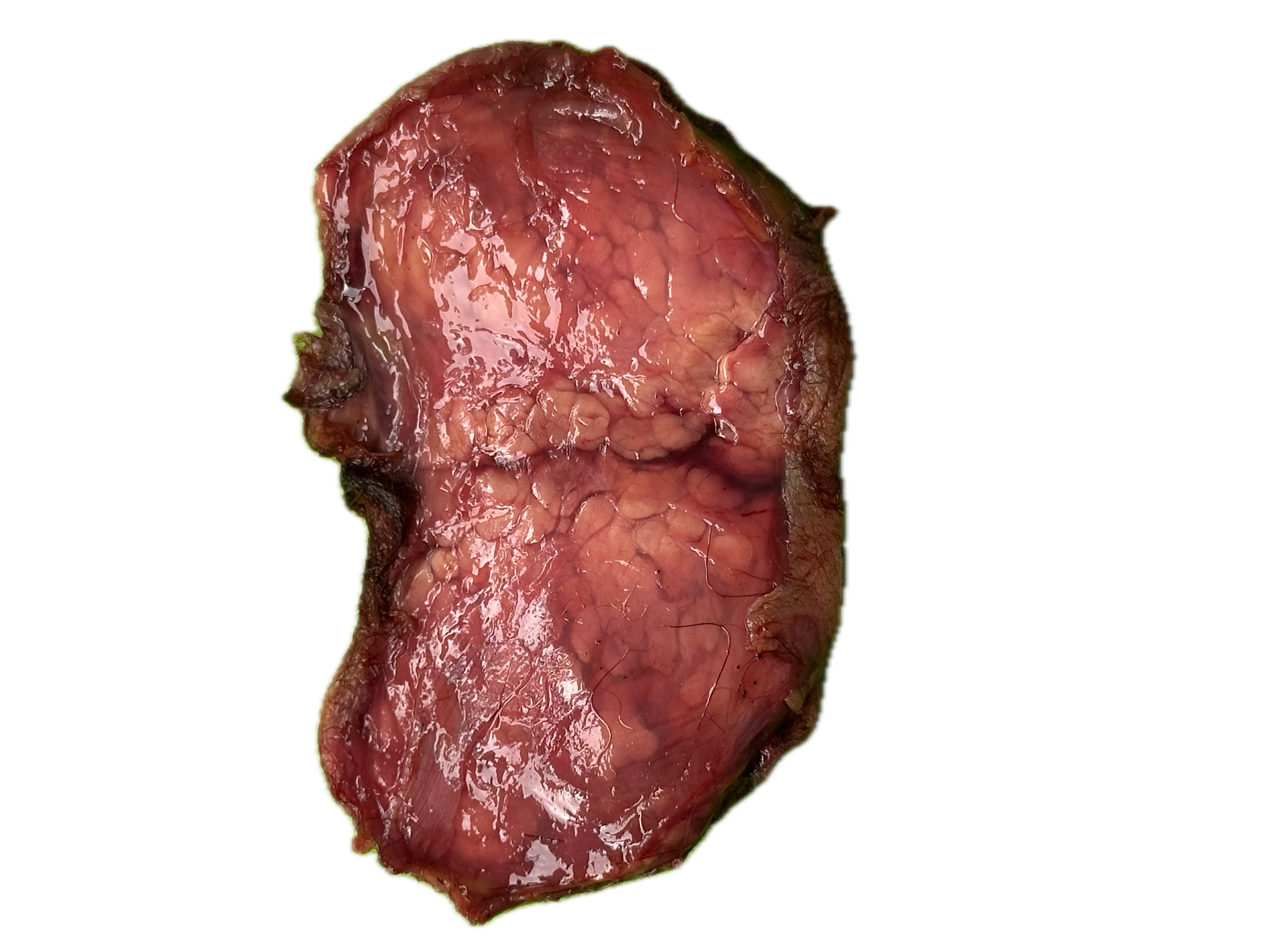 Glándula Normal 6