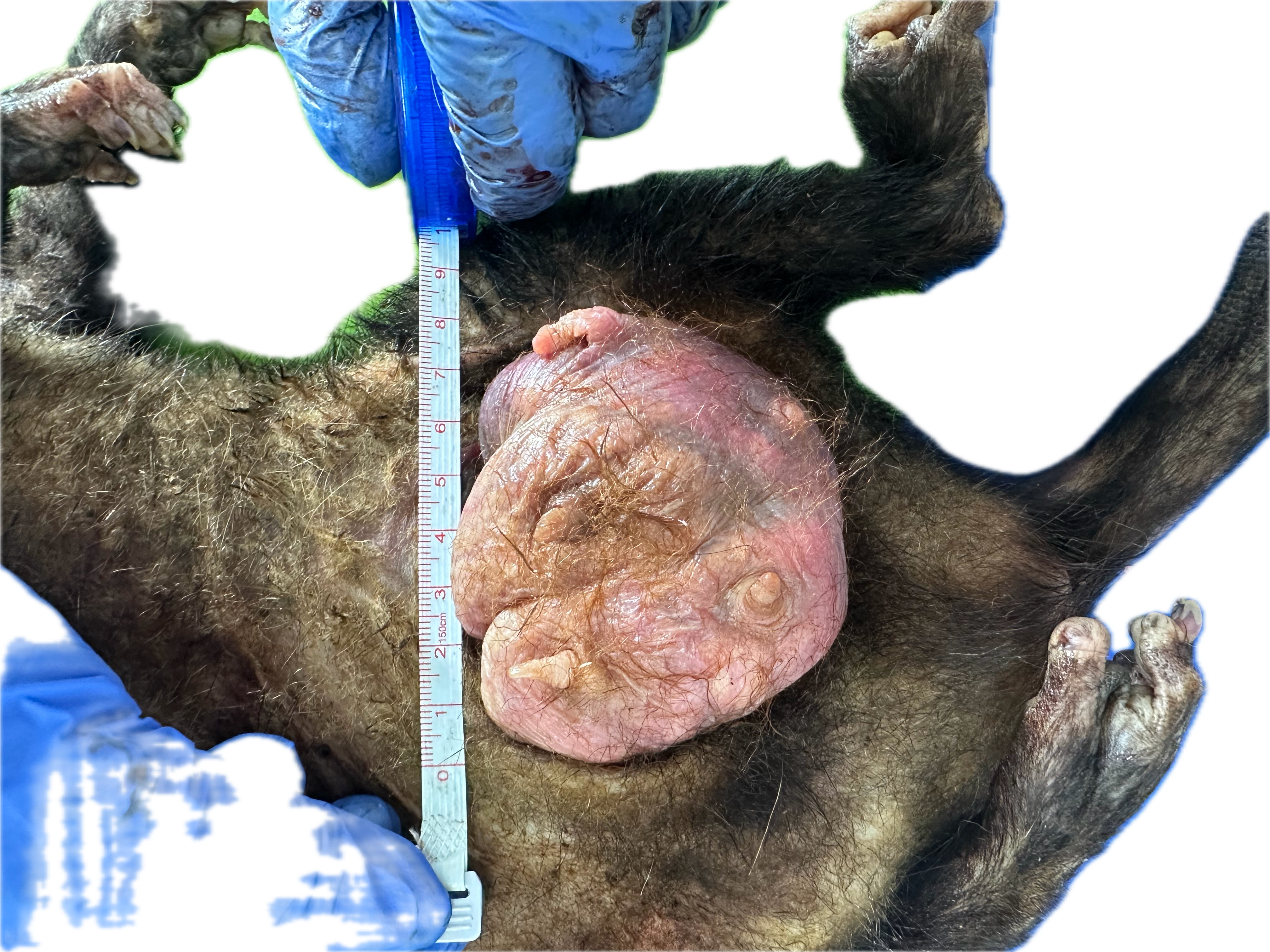 Patología Glandular 3