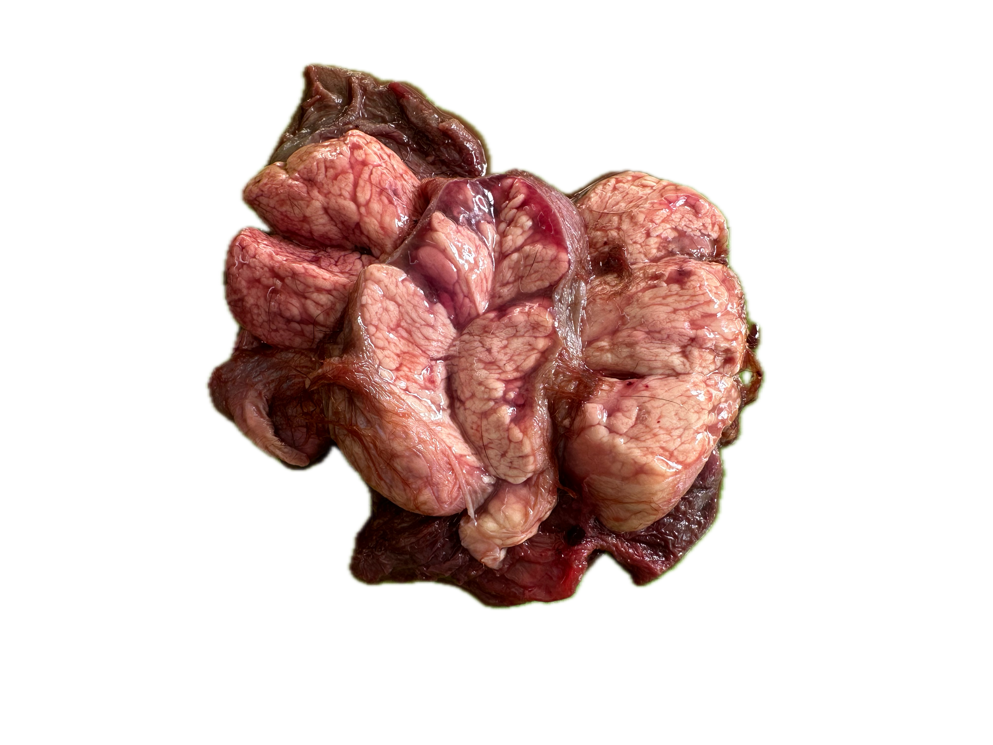 Patología Glandular 4
