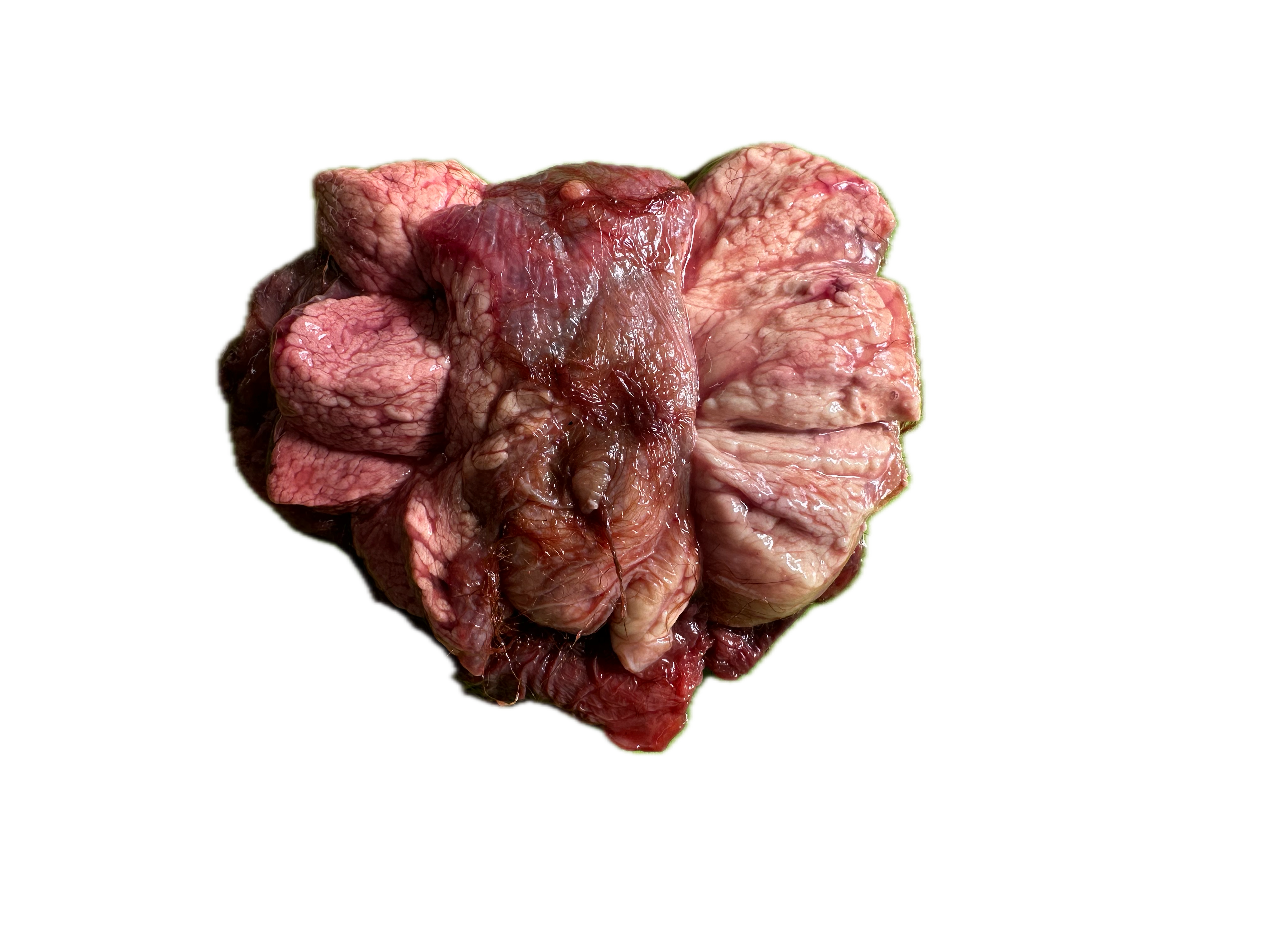 Patología Glandular 5