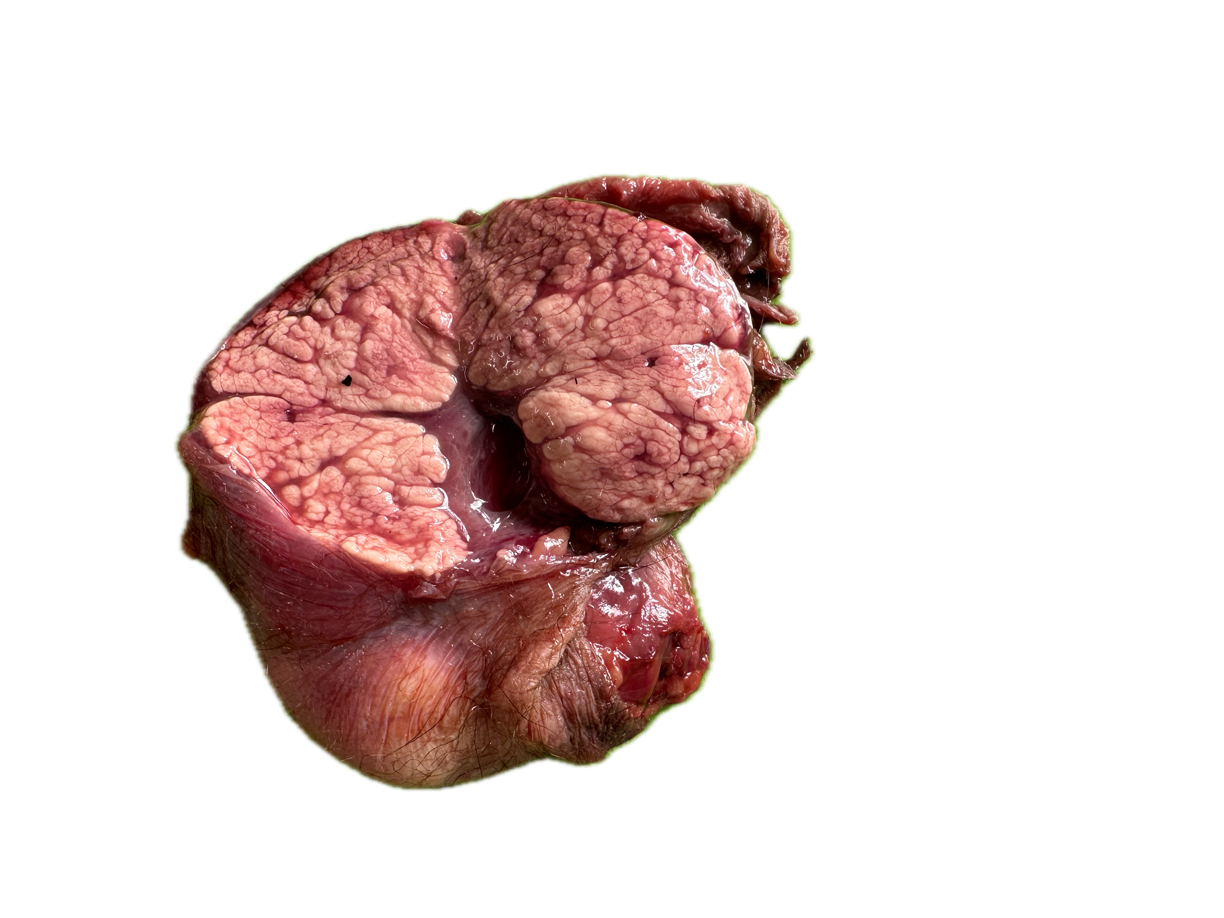 Patología Glandular 6