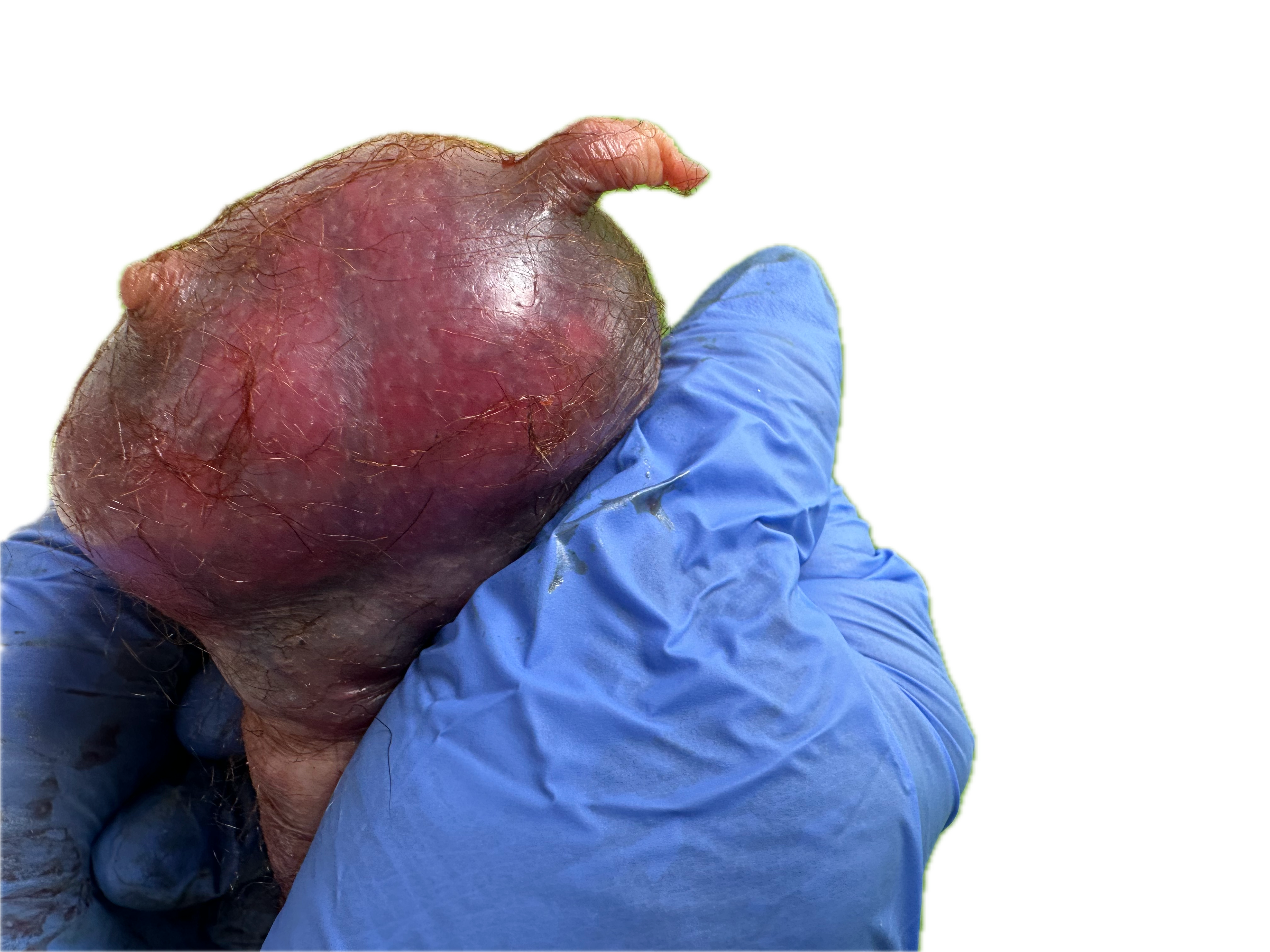 Patología Glandular 7