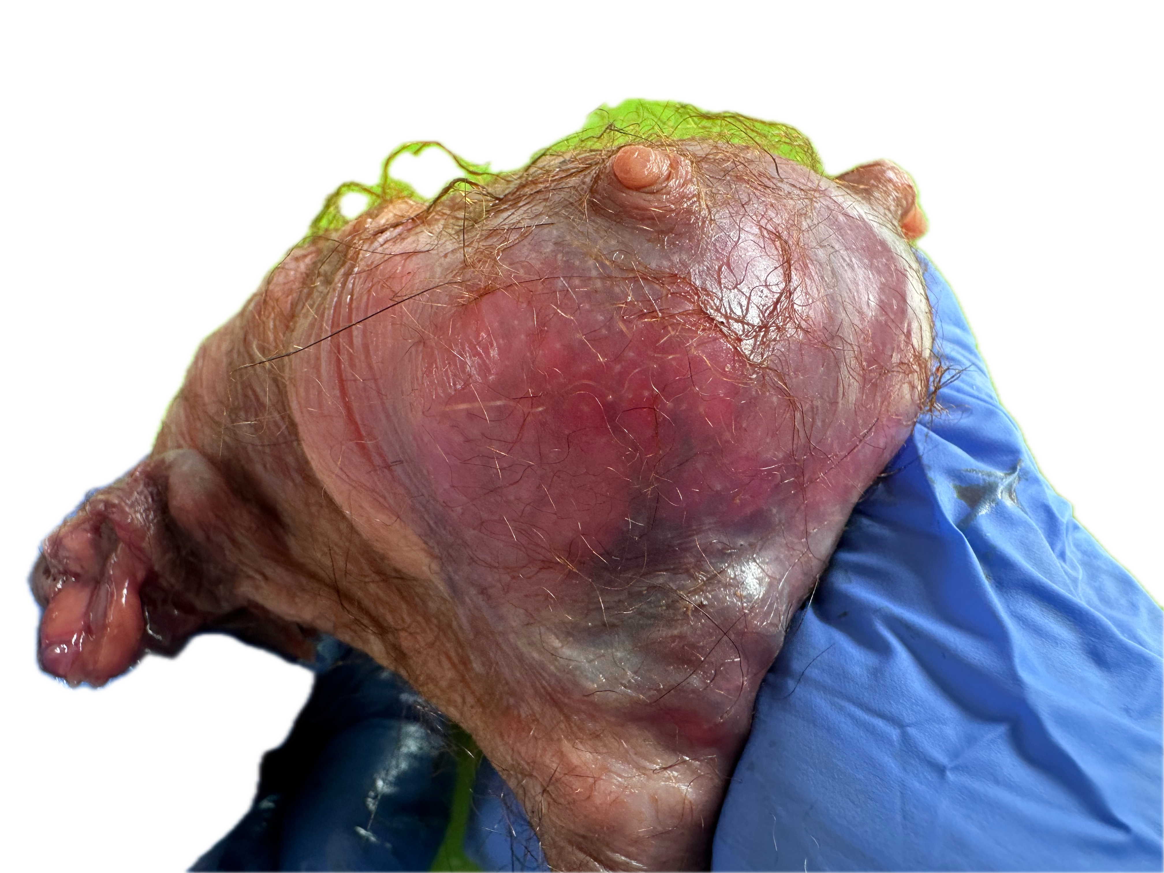 Patología Glandular 8