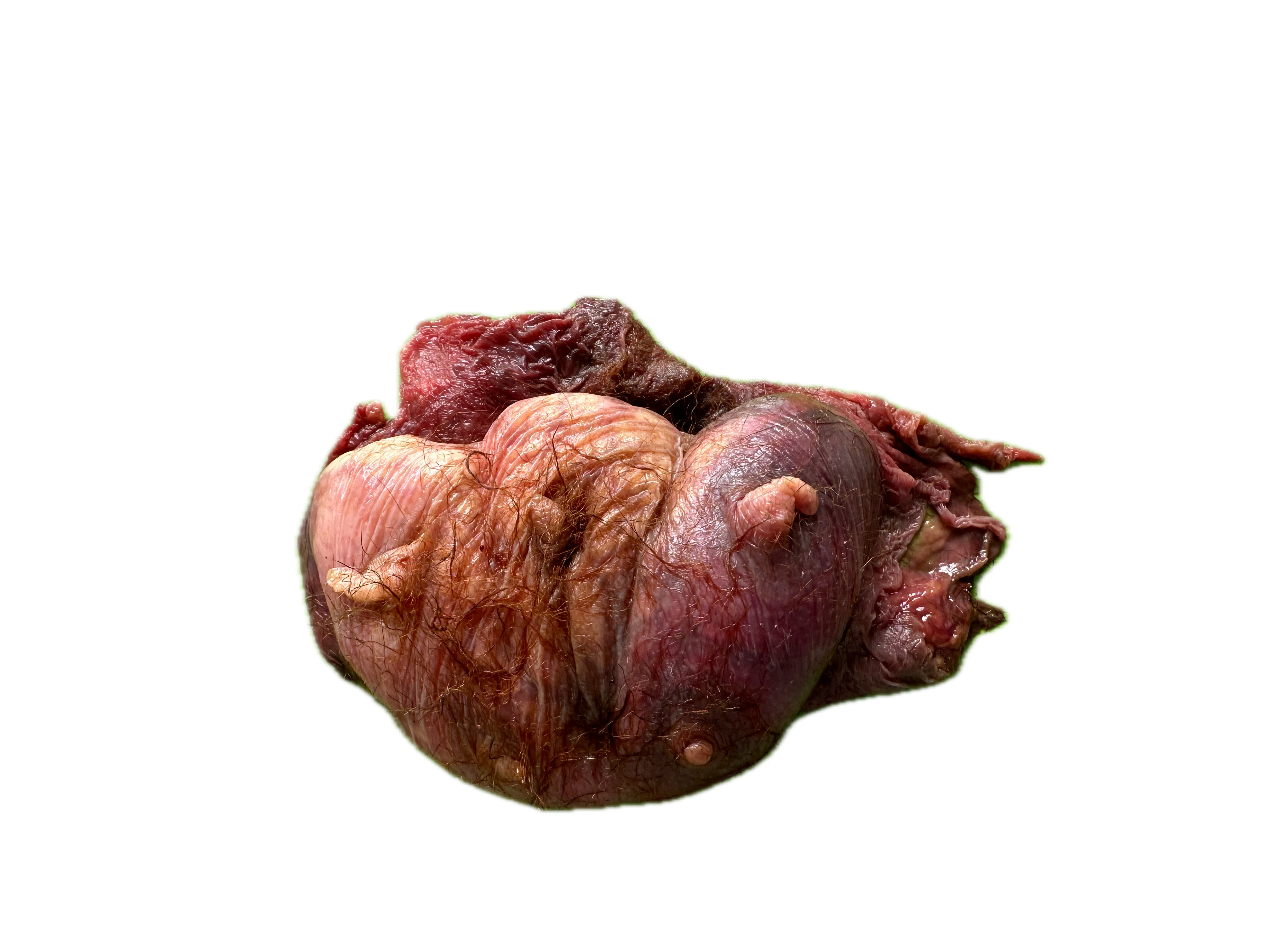 Patología Glandular 9