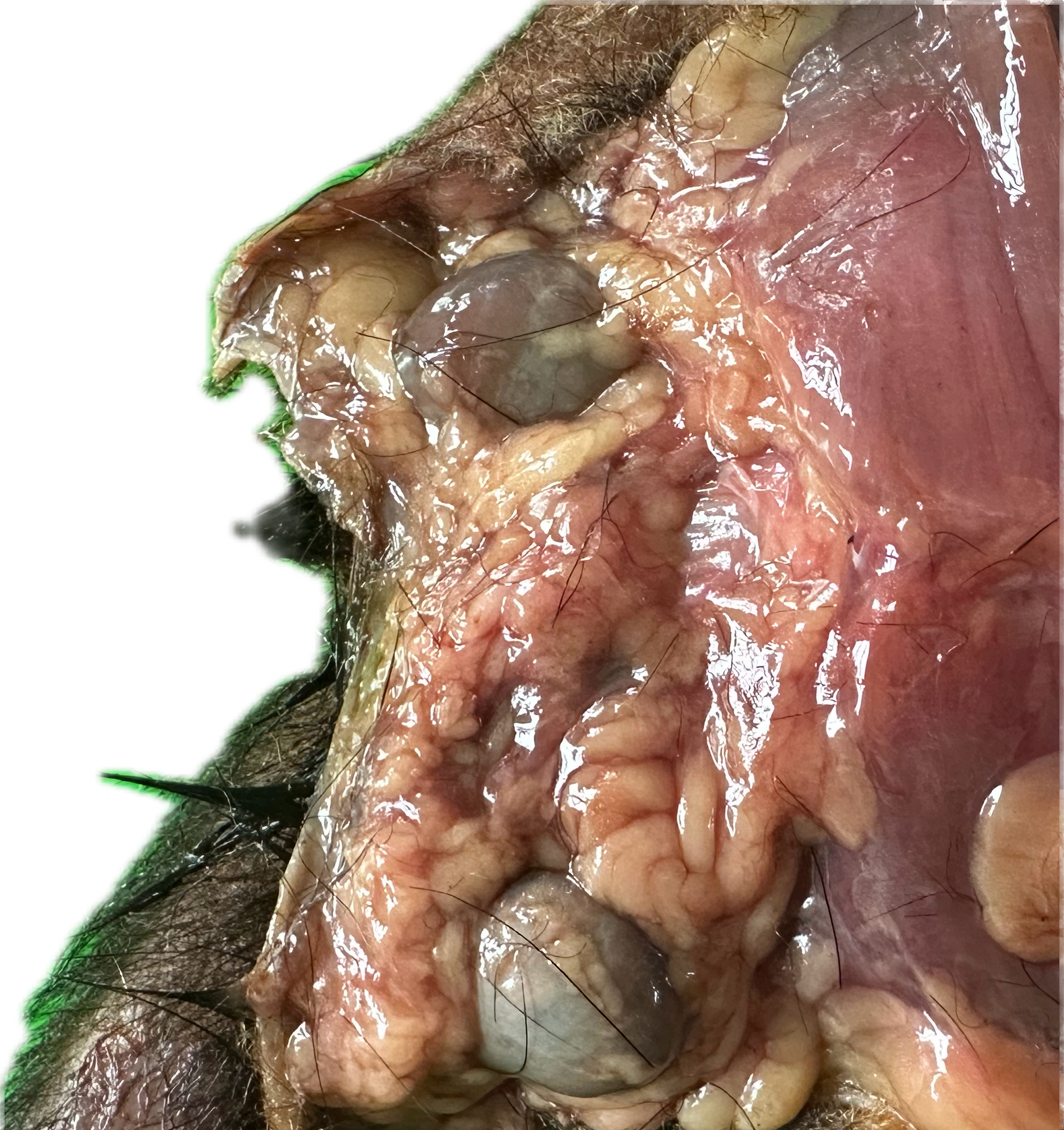 Patología Glandular 10