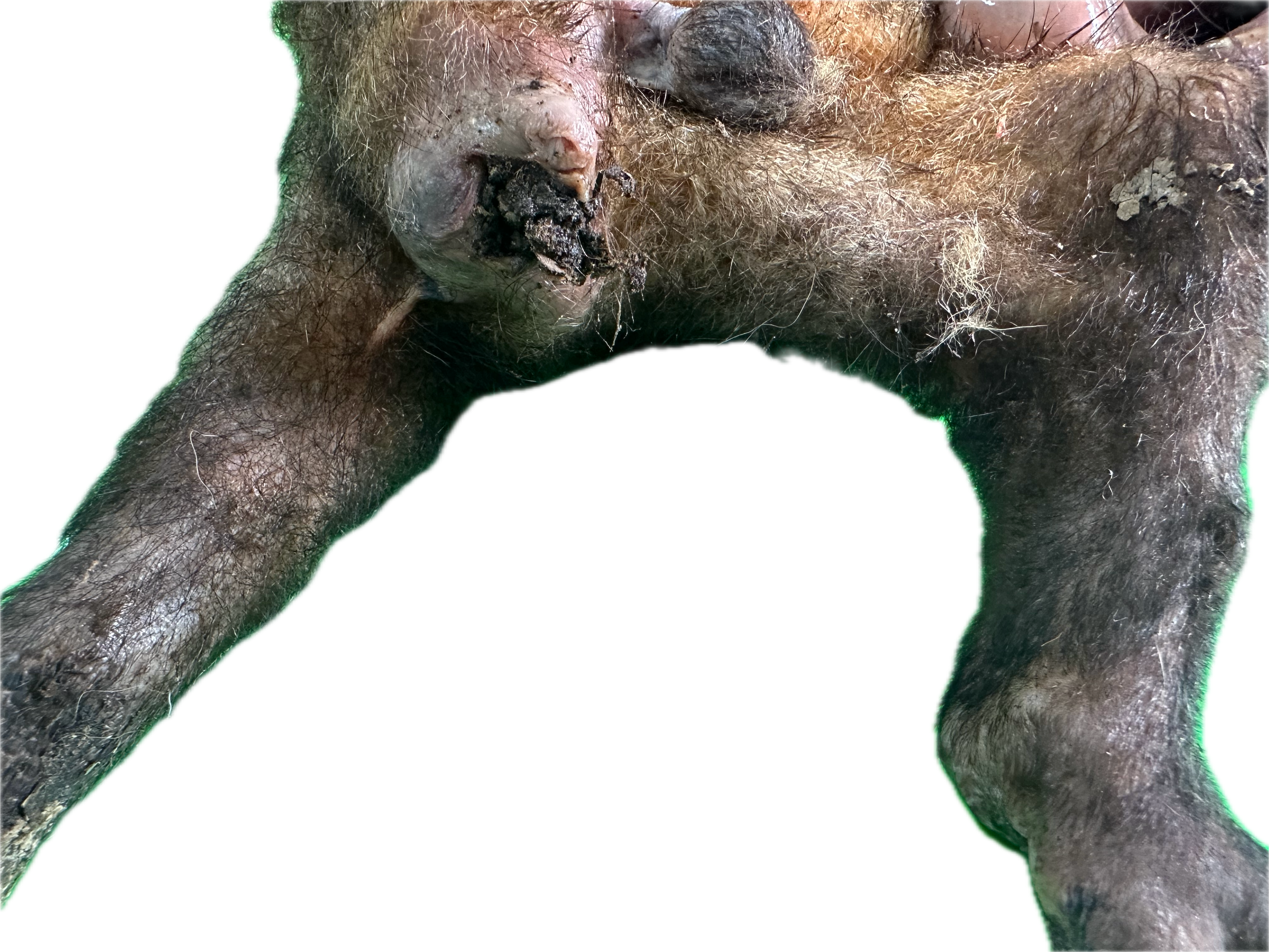 Patología Glandular 11