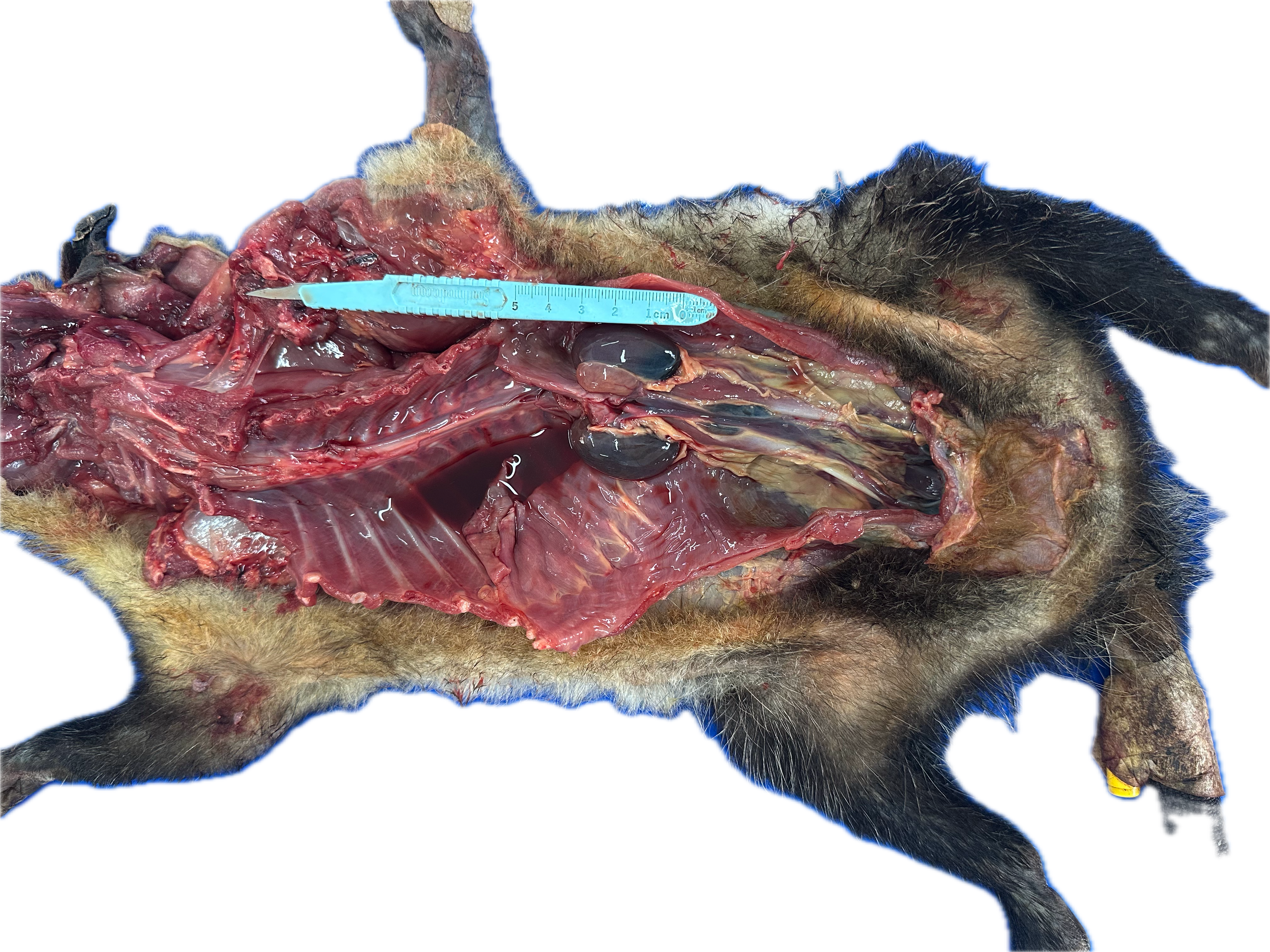 Patología Glandular 12