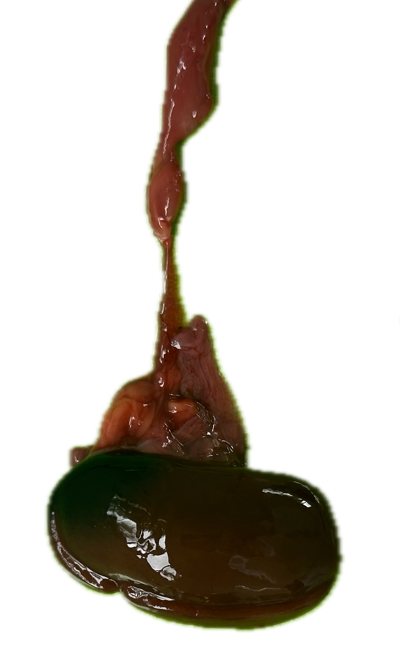 Patología Glandular 13