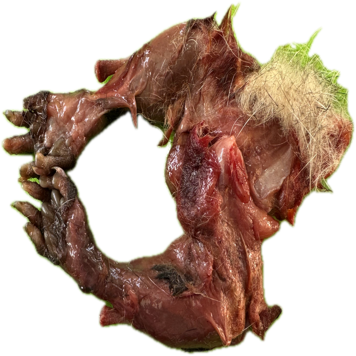 Patología Articular 1
