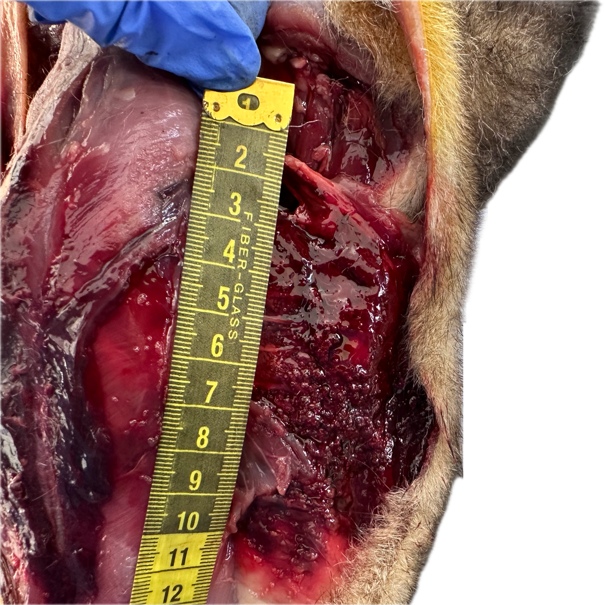 Patología Muscular 1