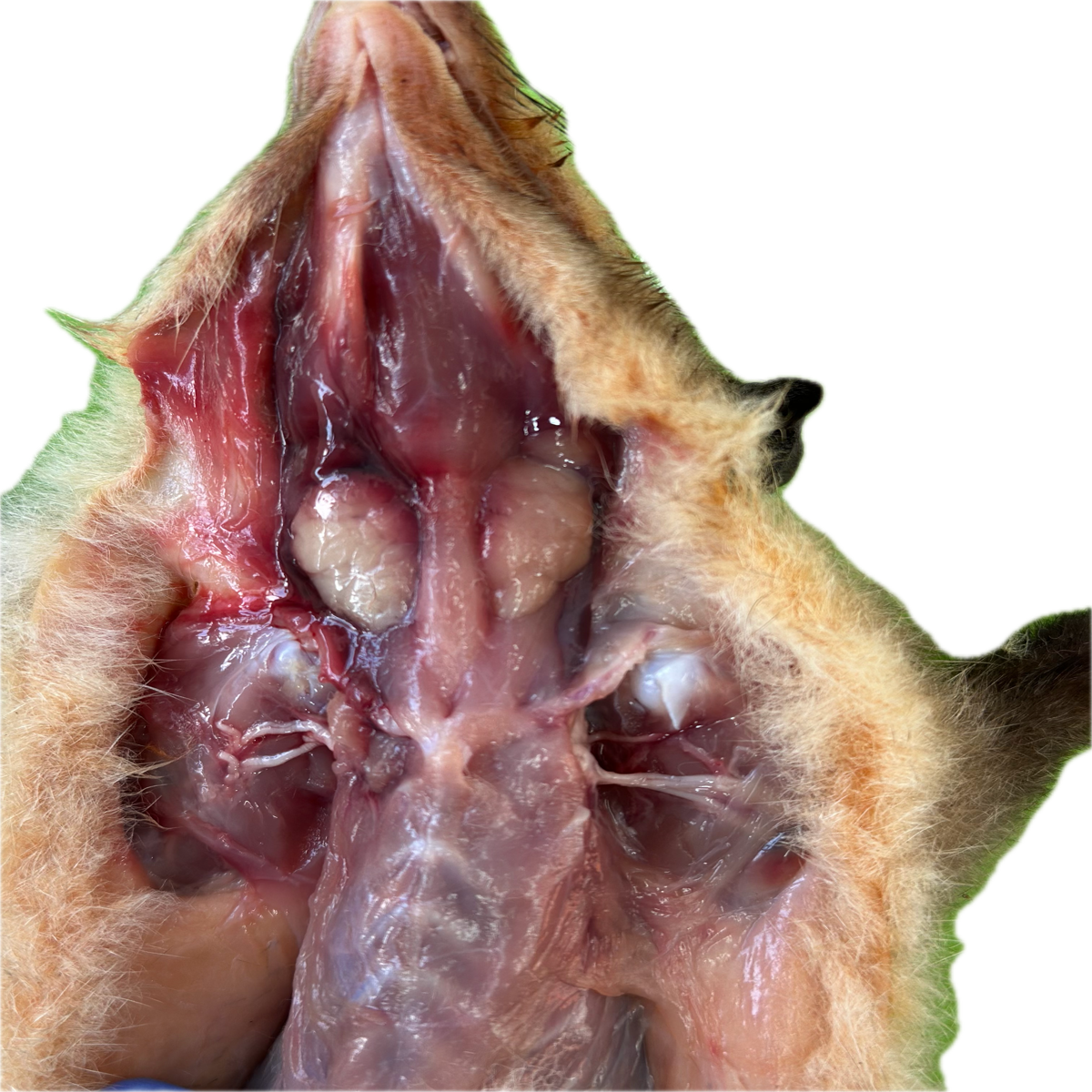Patología Muscular 17