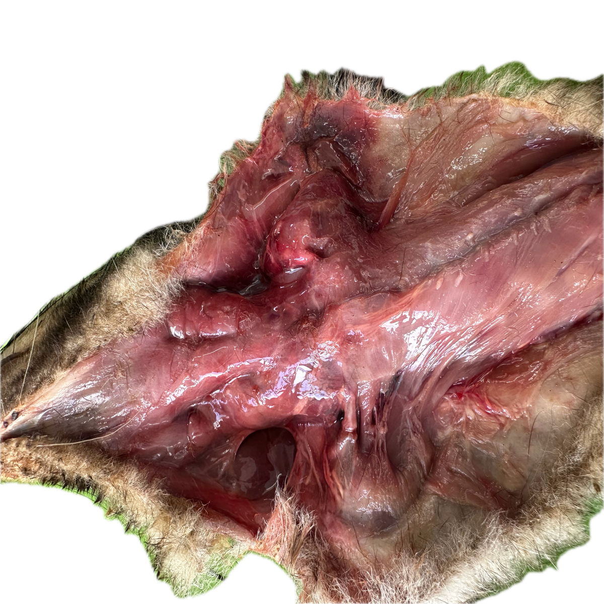 Patología Muscular 18