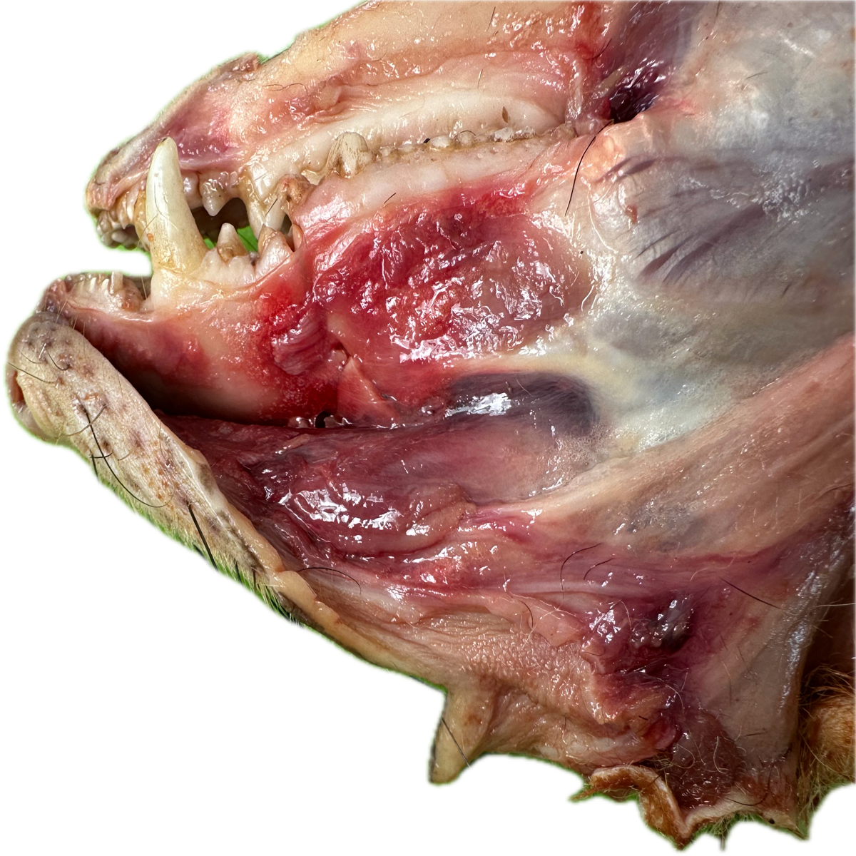 Patología Muscular 19