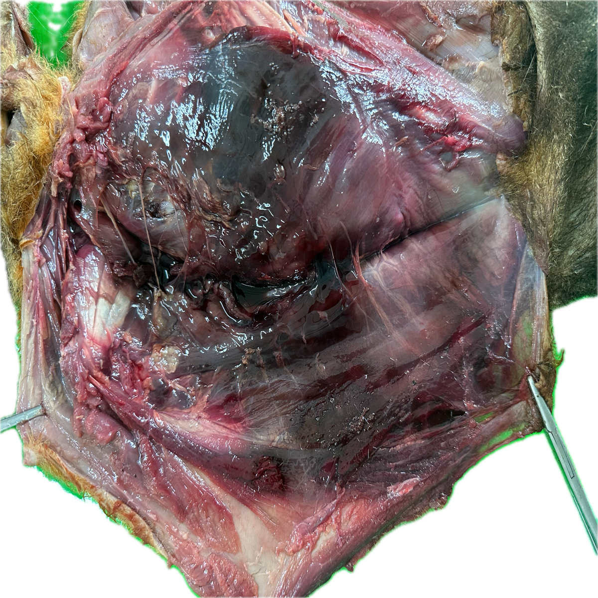 Patología Muscular 21