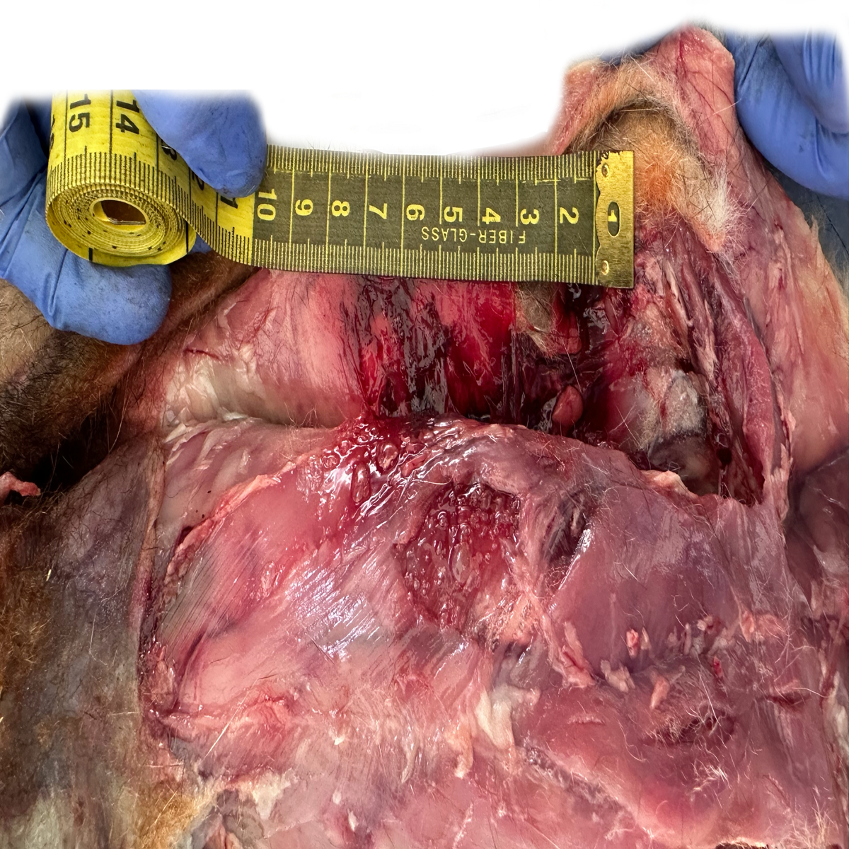 Patología Muscular 3