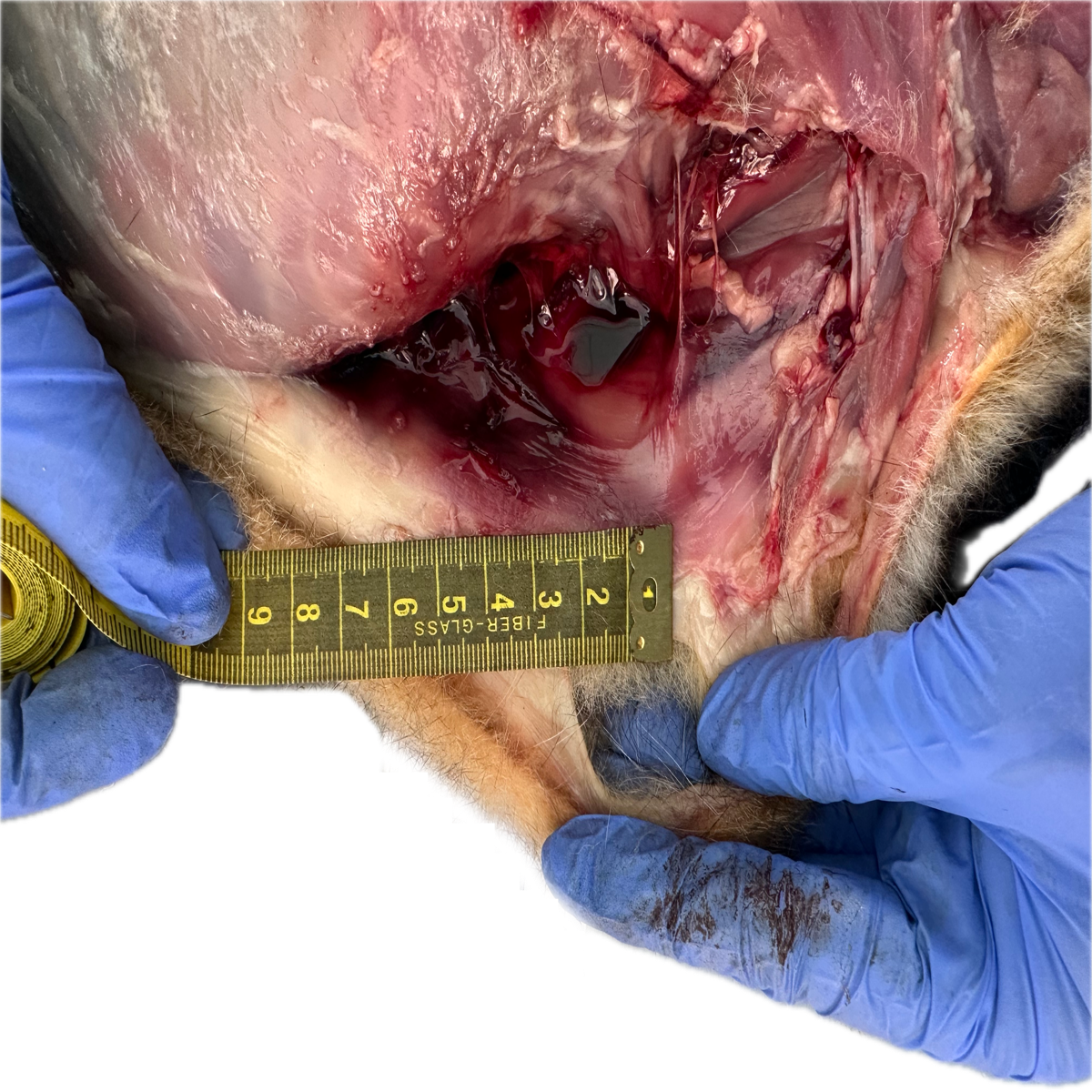 Patología Muscular 4