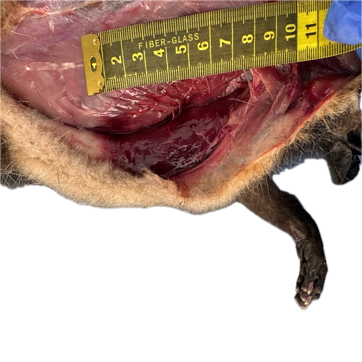 Patología Muscular 5