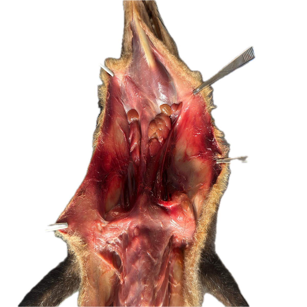 Patología Muscular 7