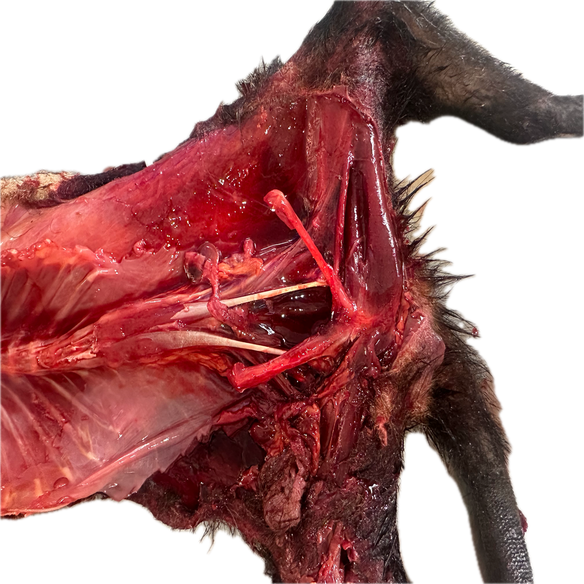 Patología Muscular 9