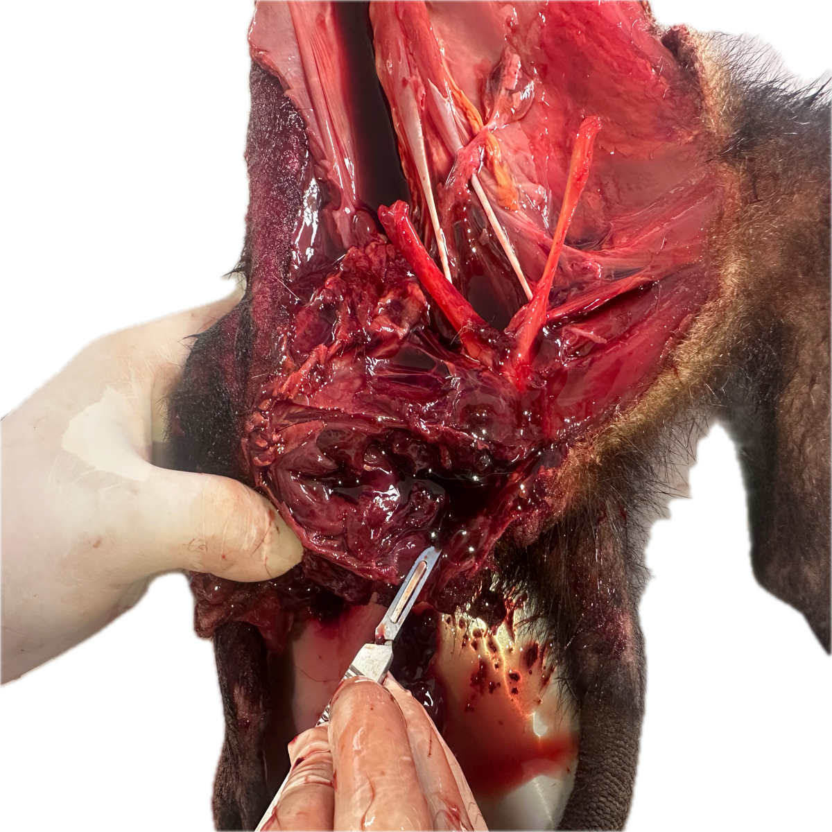 Patología Muscular 10
