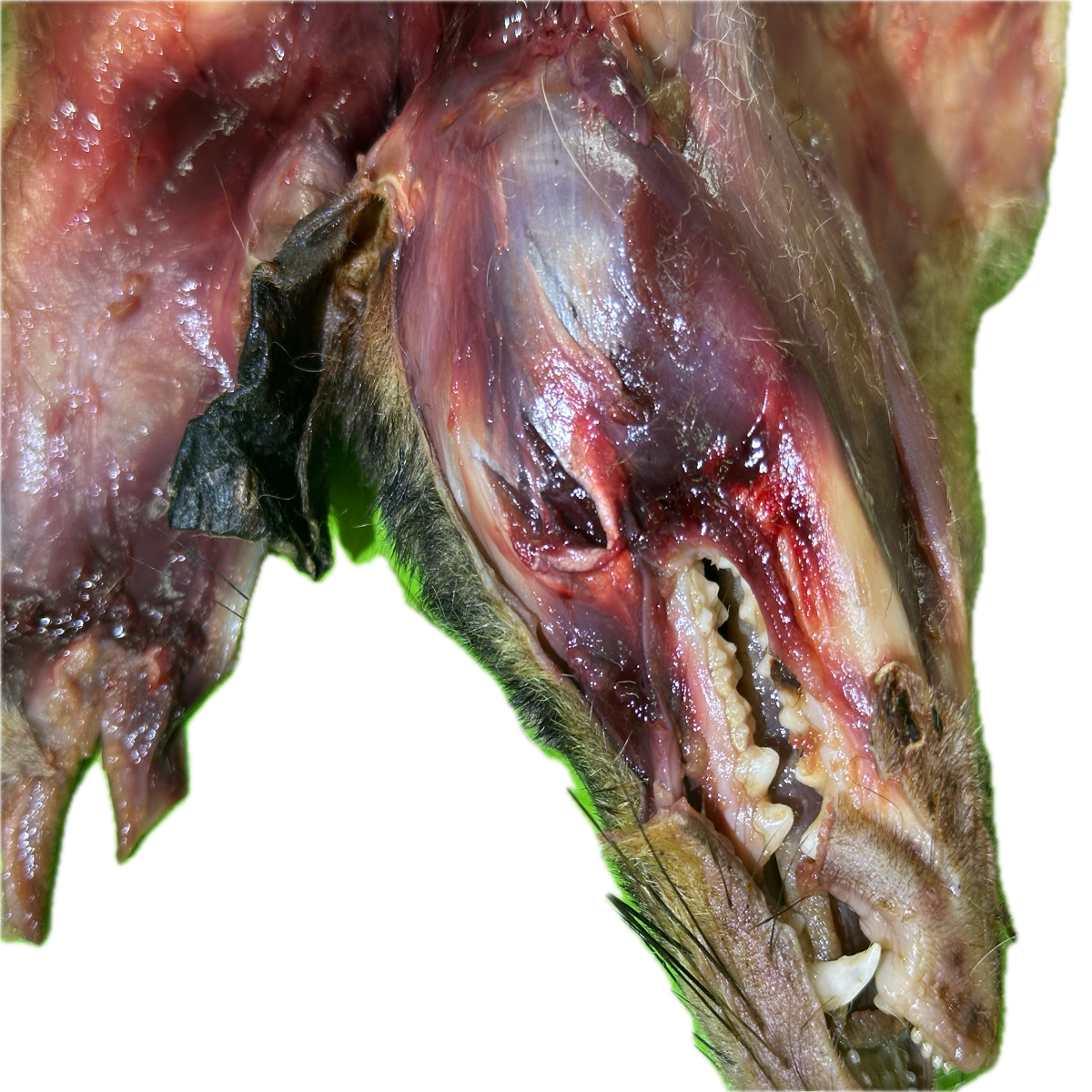 Patología Muscular 15