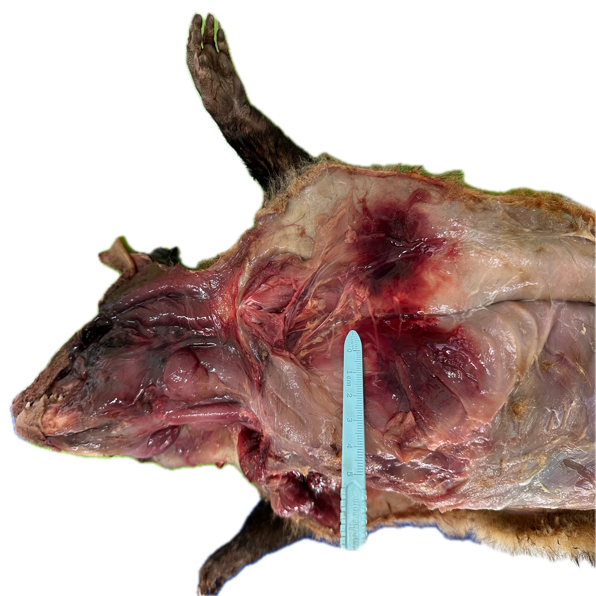 Patología Muscular 22