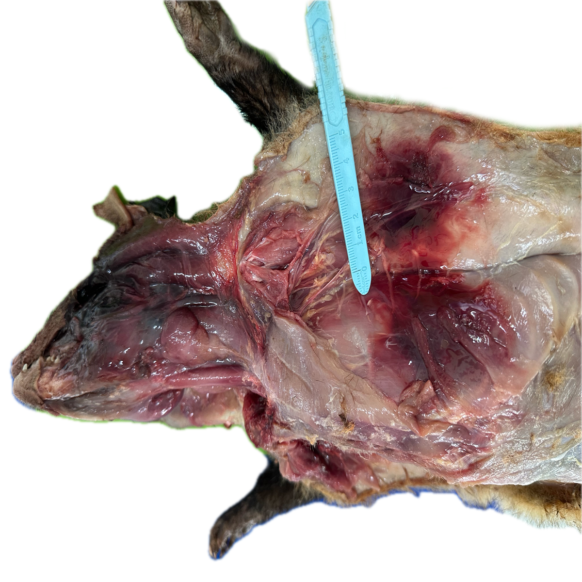Patología Muscular 23