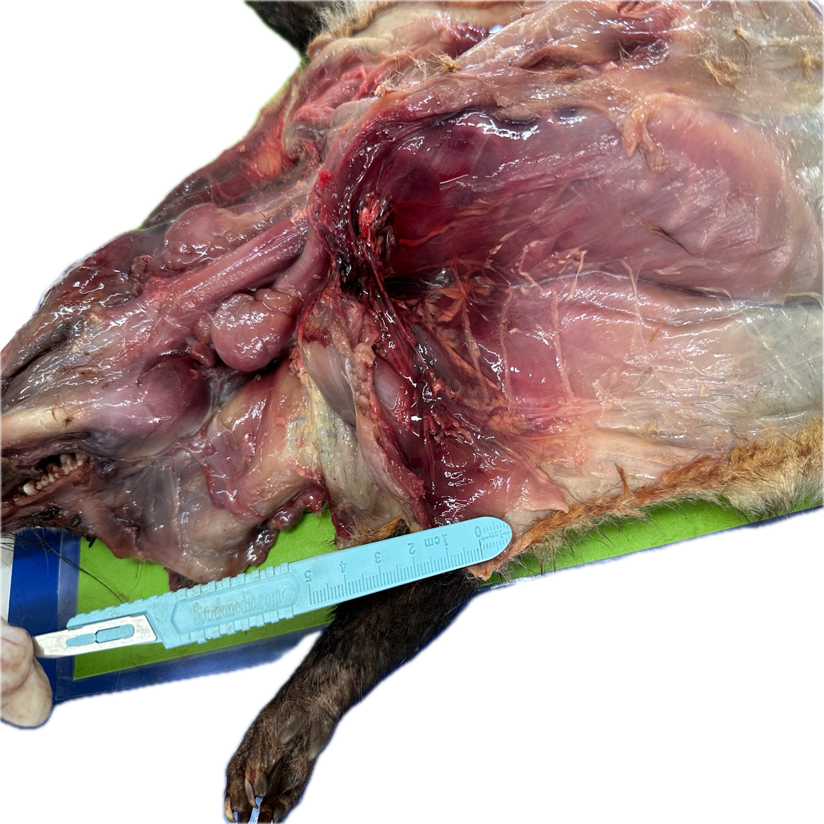Patología Muscular 24
