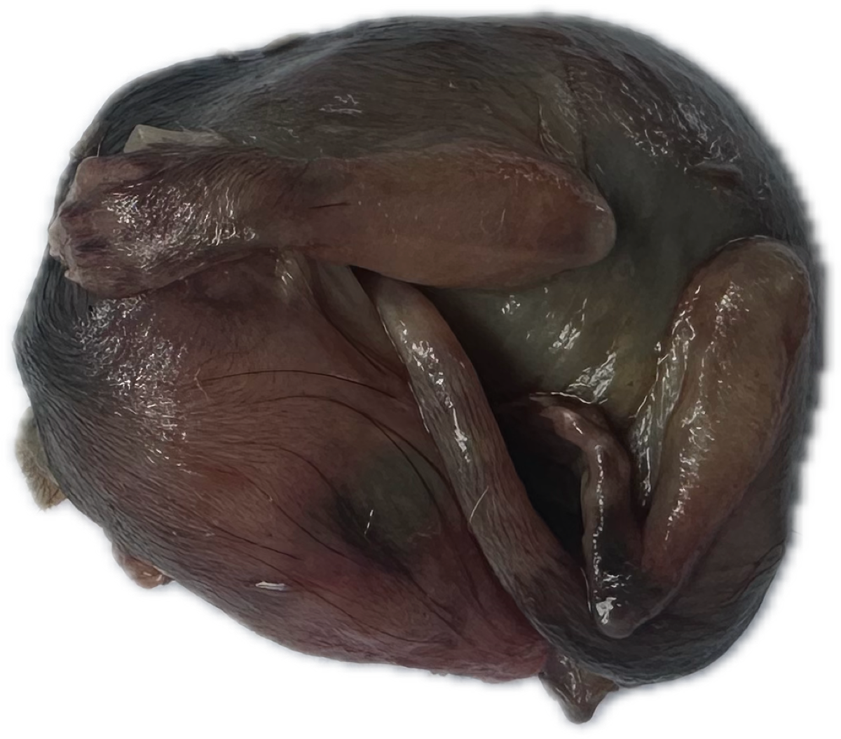 Marsupio Normal 5