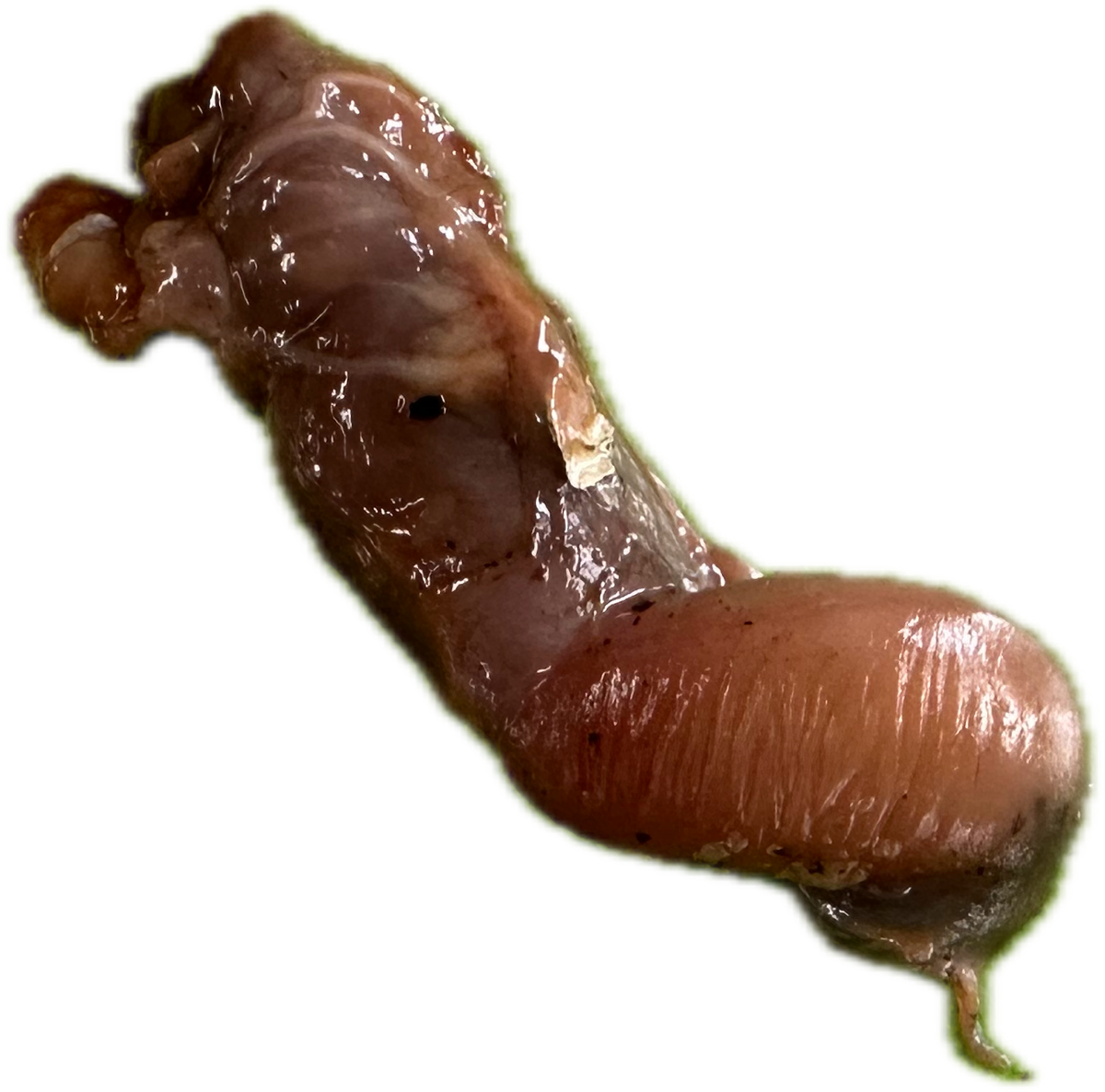 Patología Ovaria 1