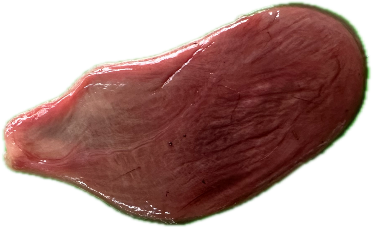Patología Ovaria 3