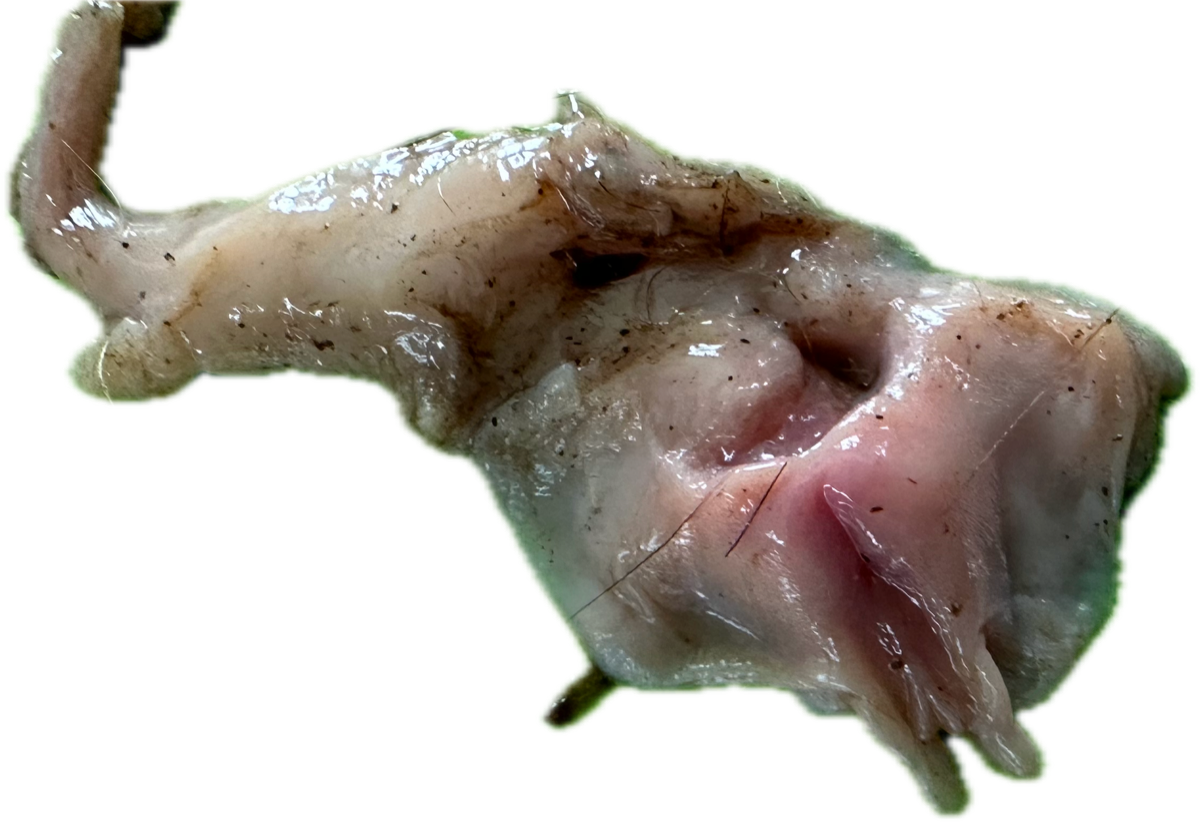 Vagina/Vulva Normal 2
