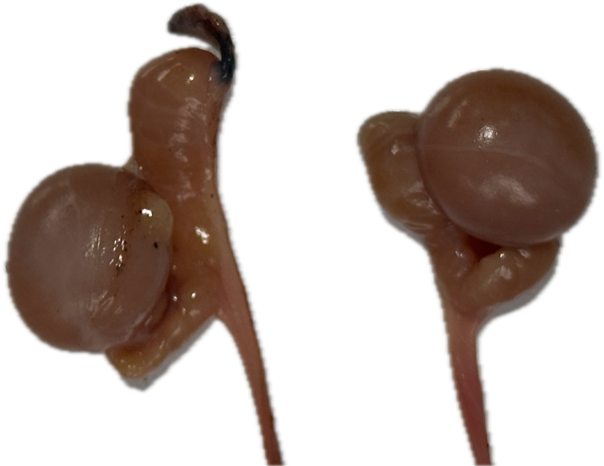 Patología Testicular 2
