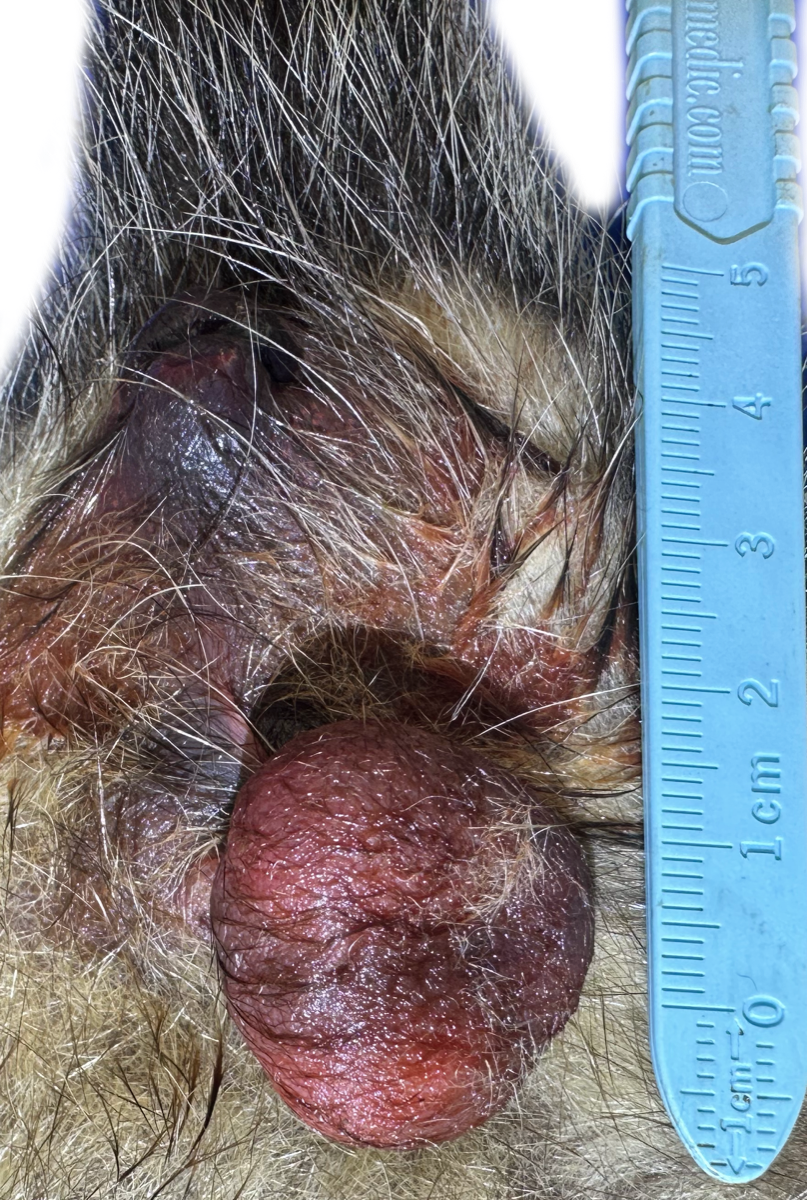 Patología Testicular 3