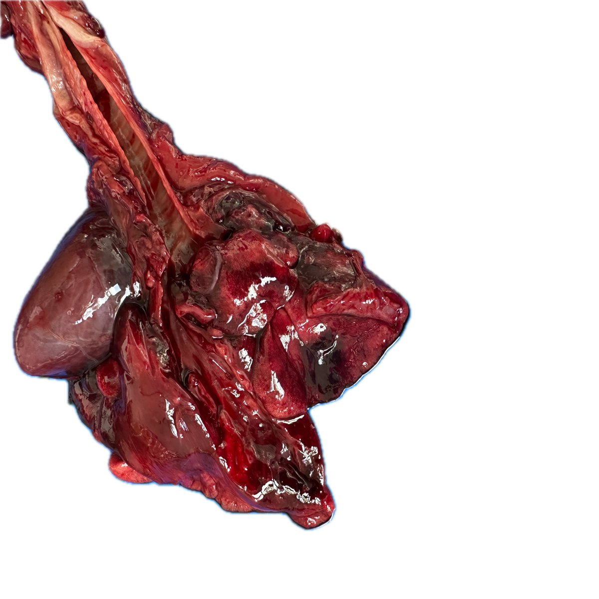 Patología Pulmonar 1