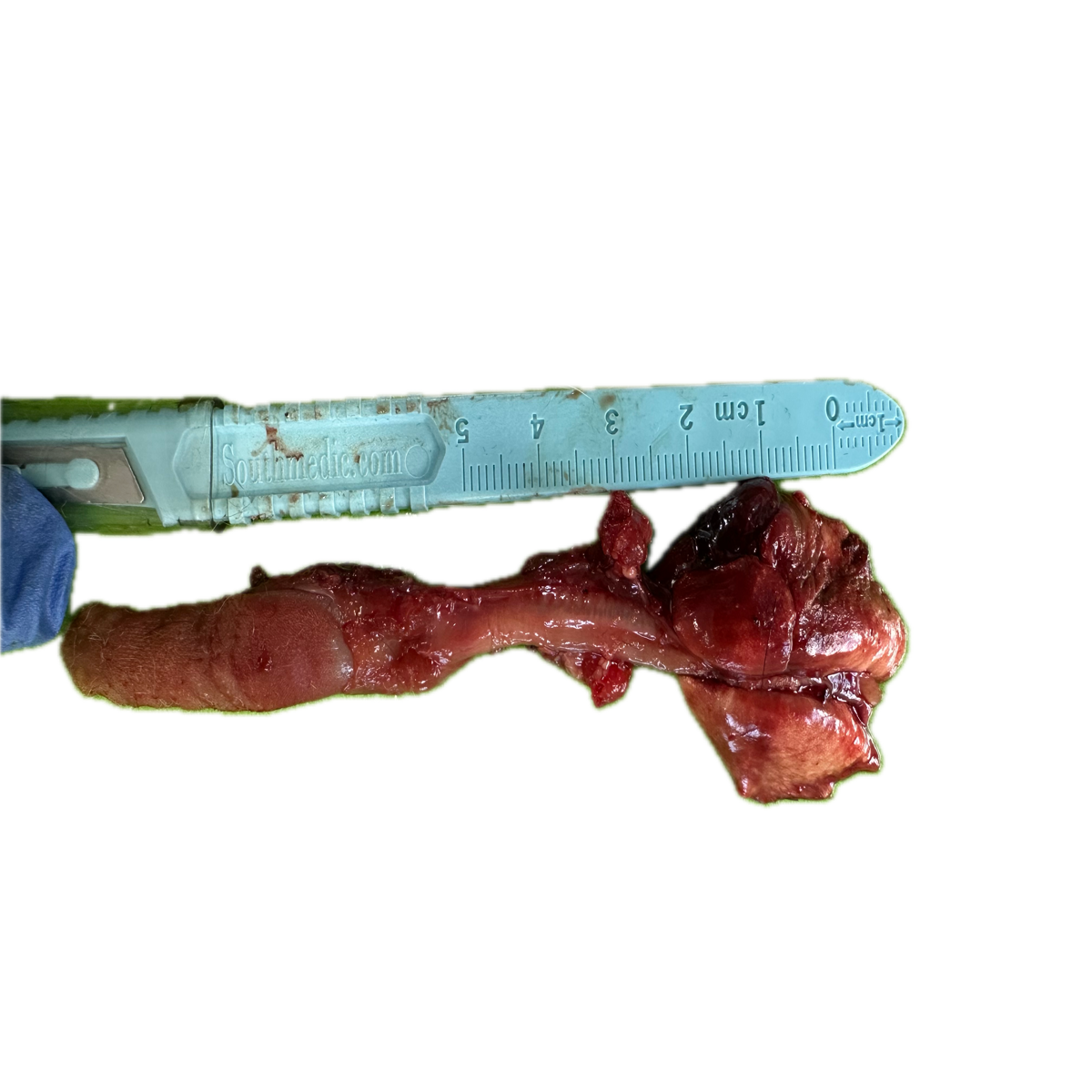 Patología Pulmonar 9