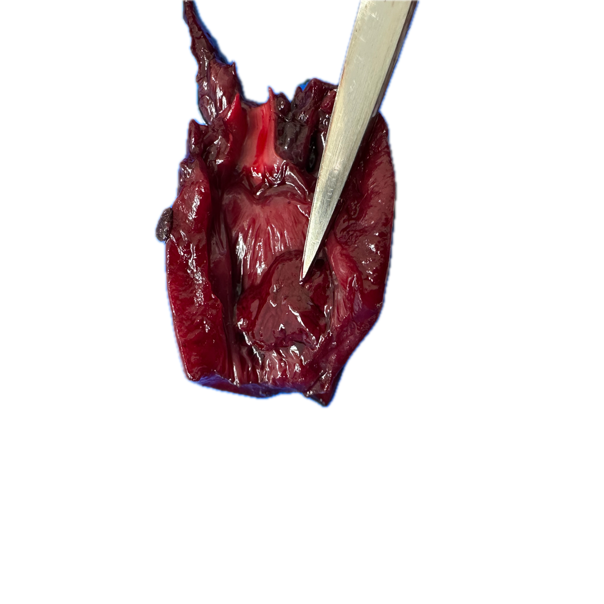 Patología Pulmonar 2